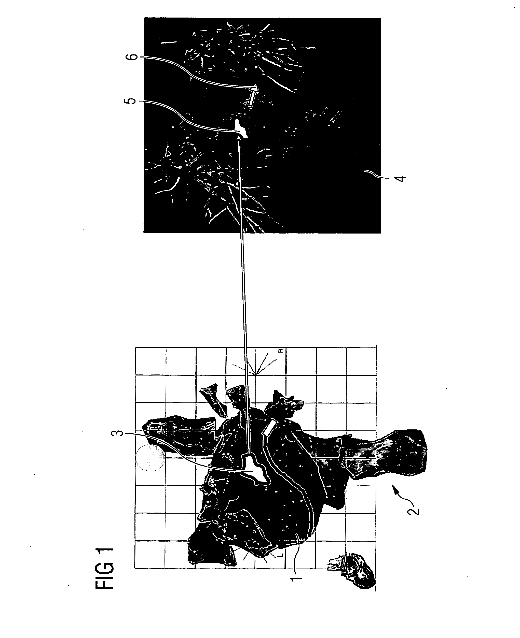 Method and apparatus for visually supporting an electrophysiological catheter application in the heart by means of bidirectional information transfer