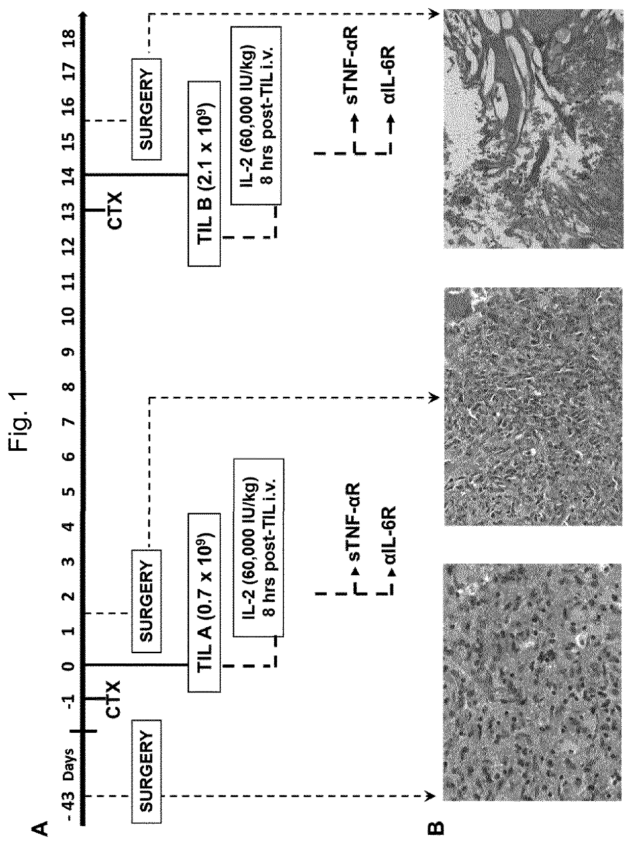 Method for the treatment of a tumor patient with adoptive t cell immunotherapy