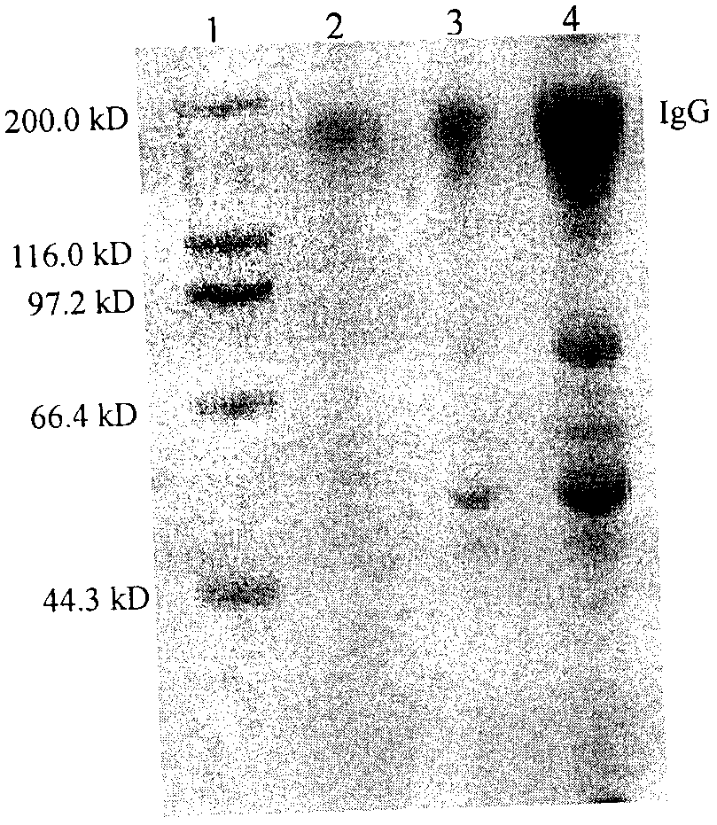 Performance improved recombination staphylococcus aureus protein A affinity ligand and construction method thereof