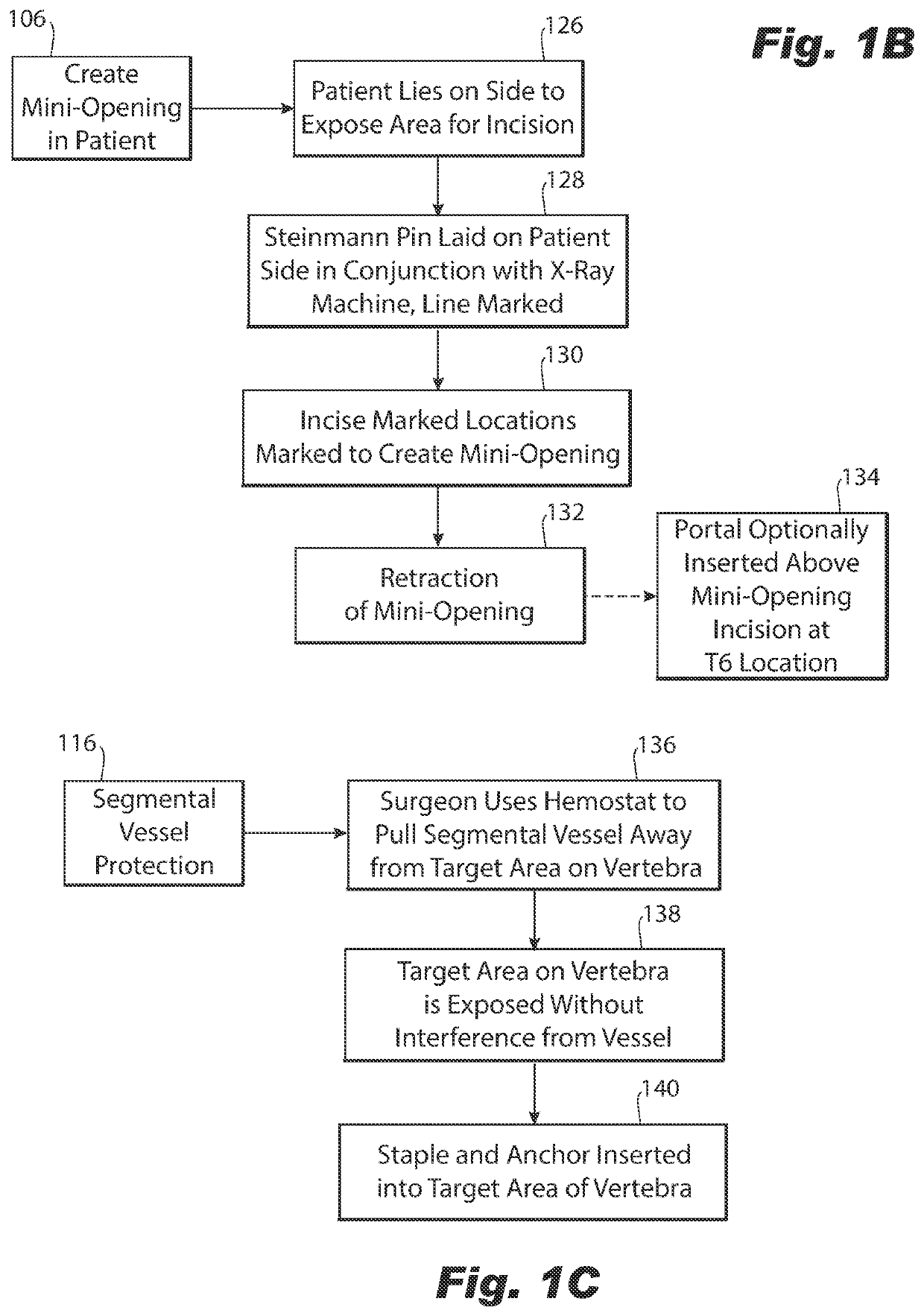 Method for improved spinal correction surgery implementing non-fusion anterior scoliosis correction techniques for release of discs