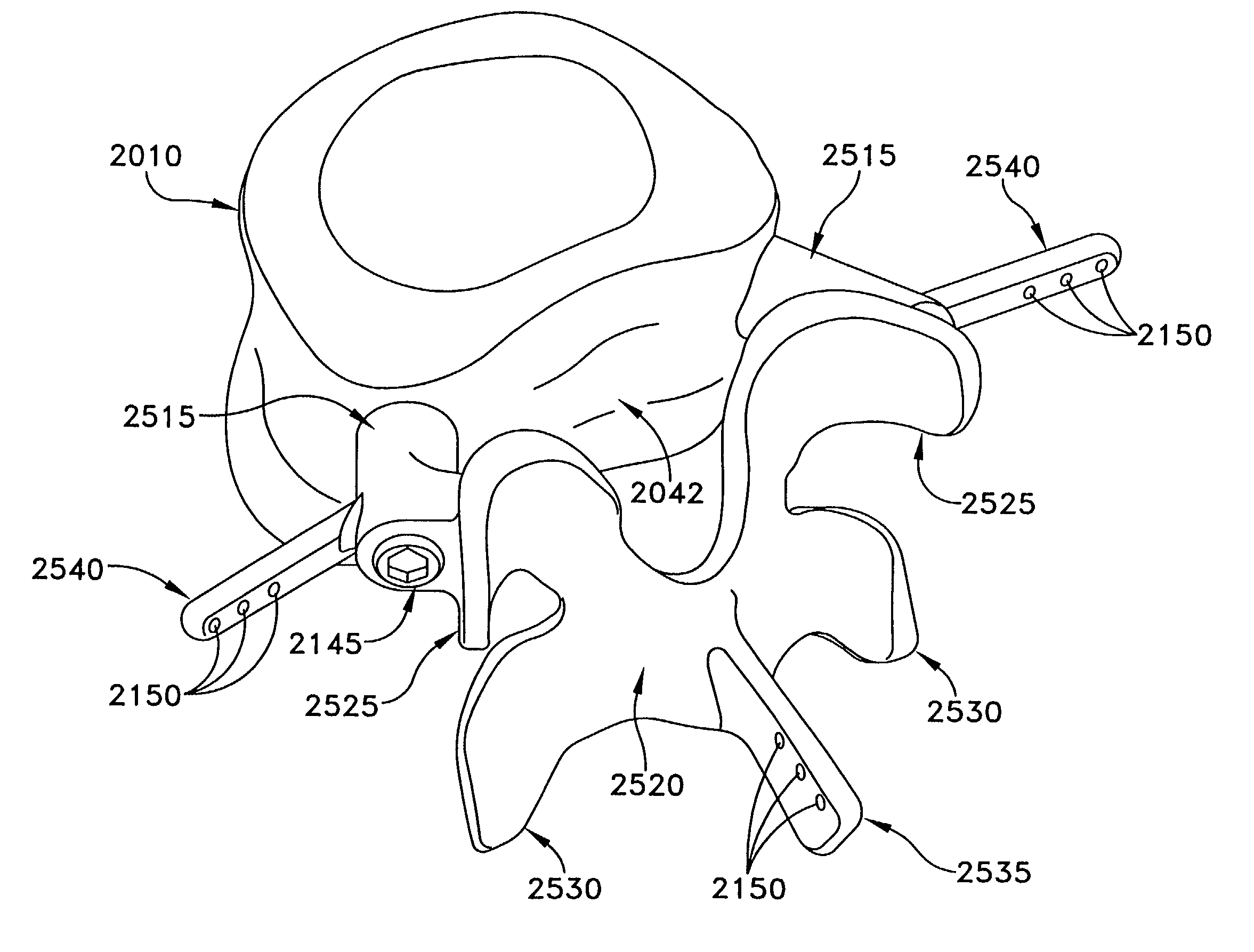Method and apparatus for spine joint replacement
