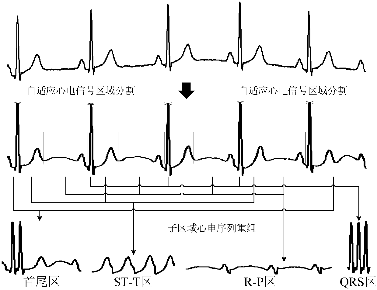 Linear reconstruction method of standard number 12 lead electrocardiogram segments based on self-adaptive electrocardiosignal region segmentation
