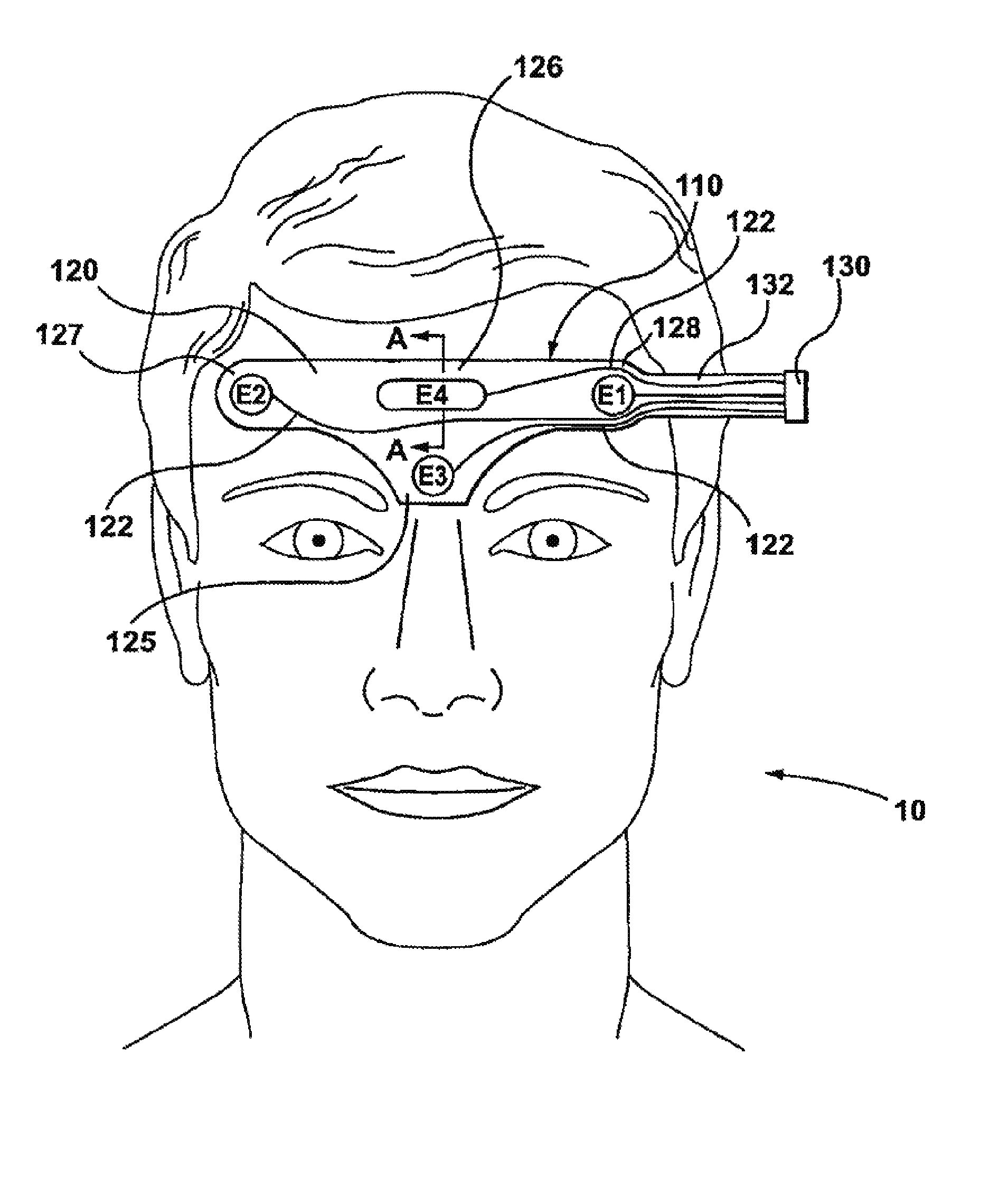 System for Sleep Stage Determination Using Frontal Electrodes