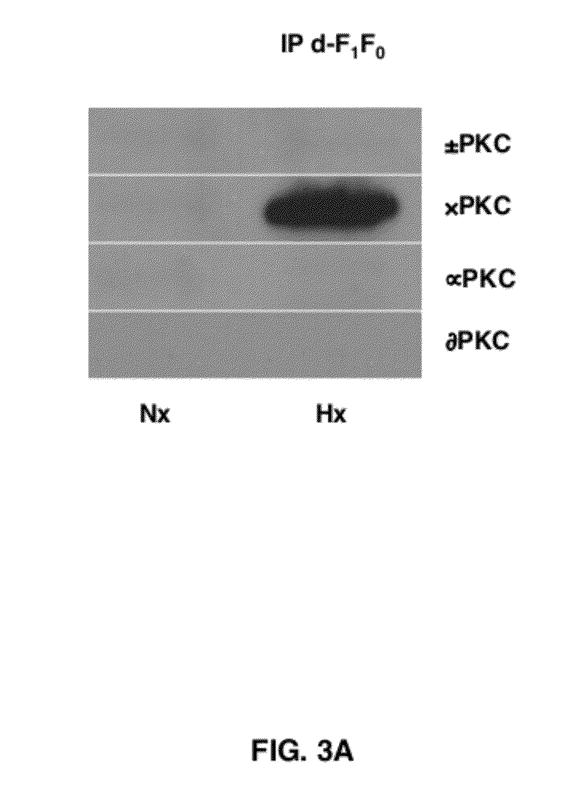 Peptide Modulators of the deltaPKC Interaction with the d Subunit of F1F0 ATP Synthase/ATPase and Uses Thereof