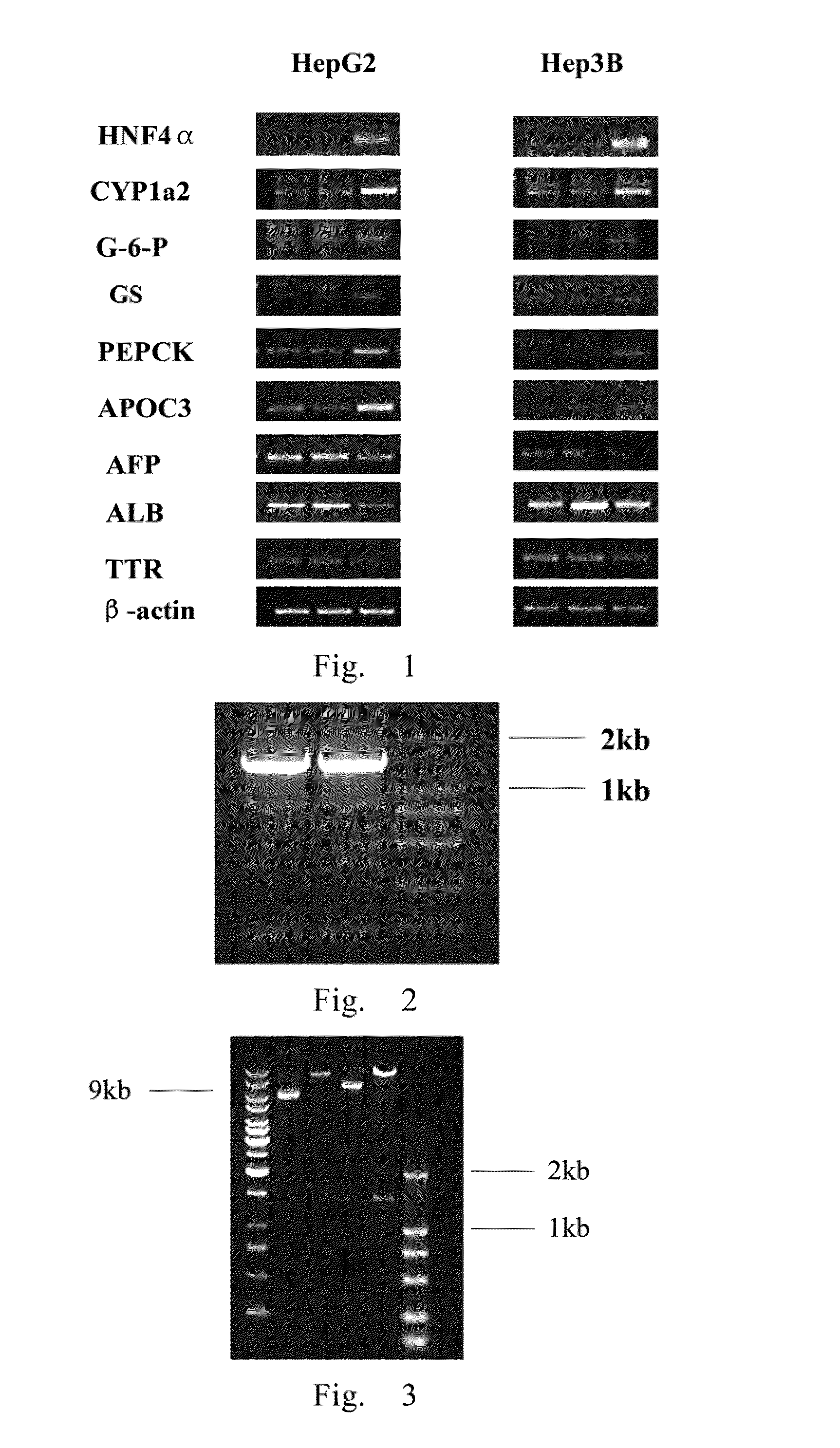 Use of hnf4alpha for treatment of human malignant solid tumors through induction-differentiation therapy