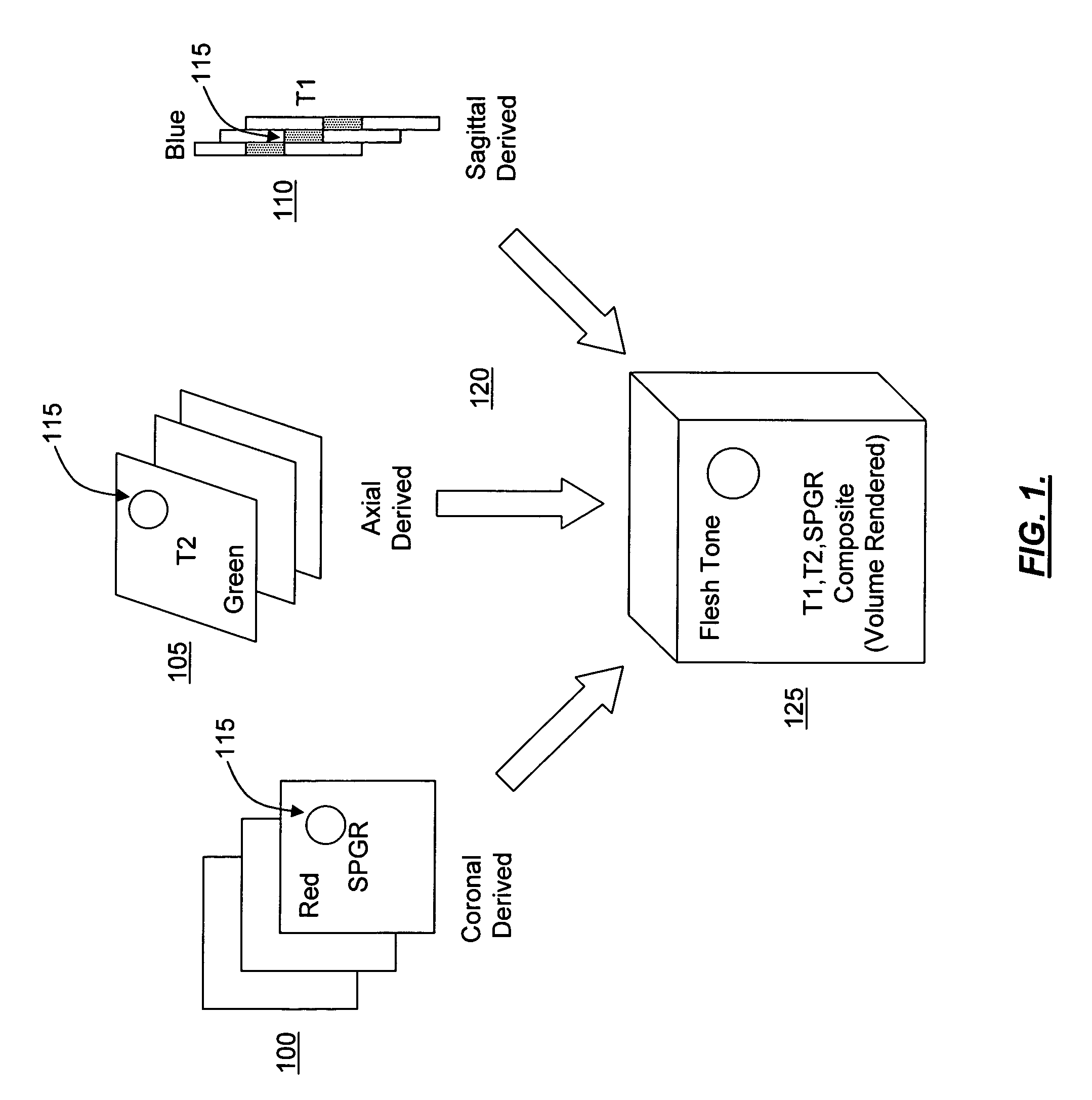 Opposed orthogonal fusion system and method for generating color segmented MRI voxel matrices