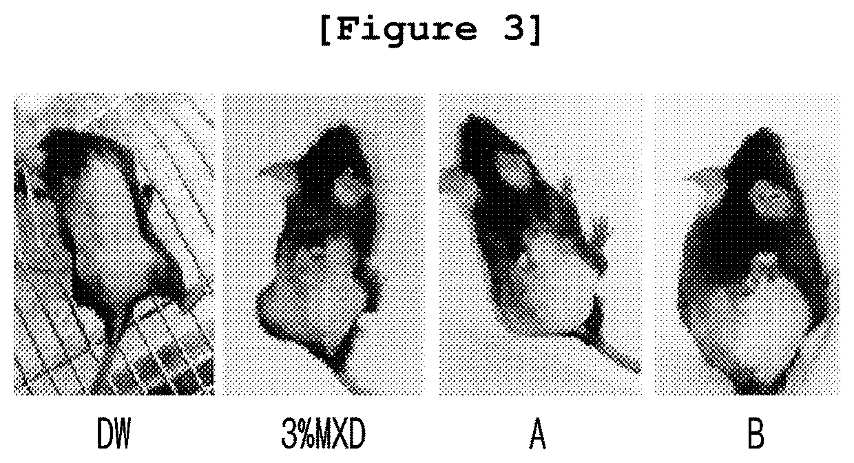 Pharmaceutical composition for the prevention or treatment of alopecia comprising eremochloa ophiuroides extract or fractions thereof as an active ingredient