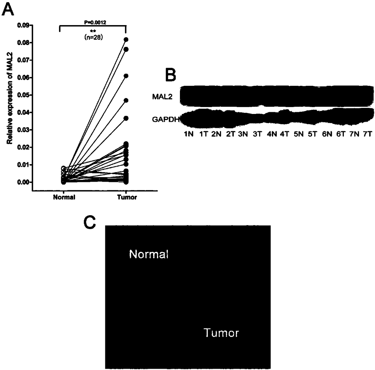 Non-small-cell lung carcinoma molecular marker and applications thereof