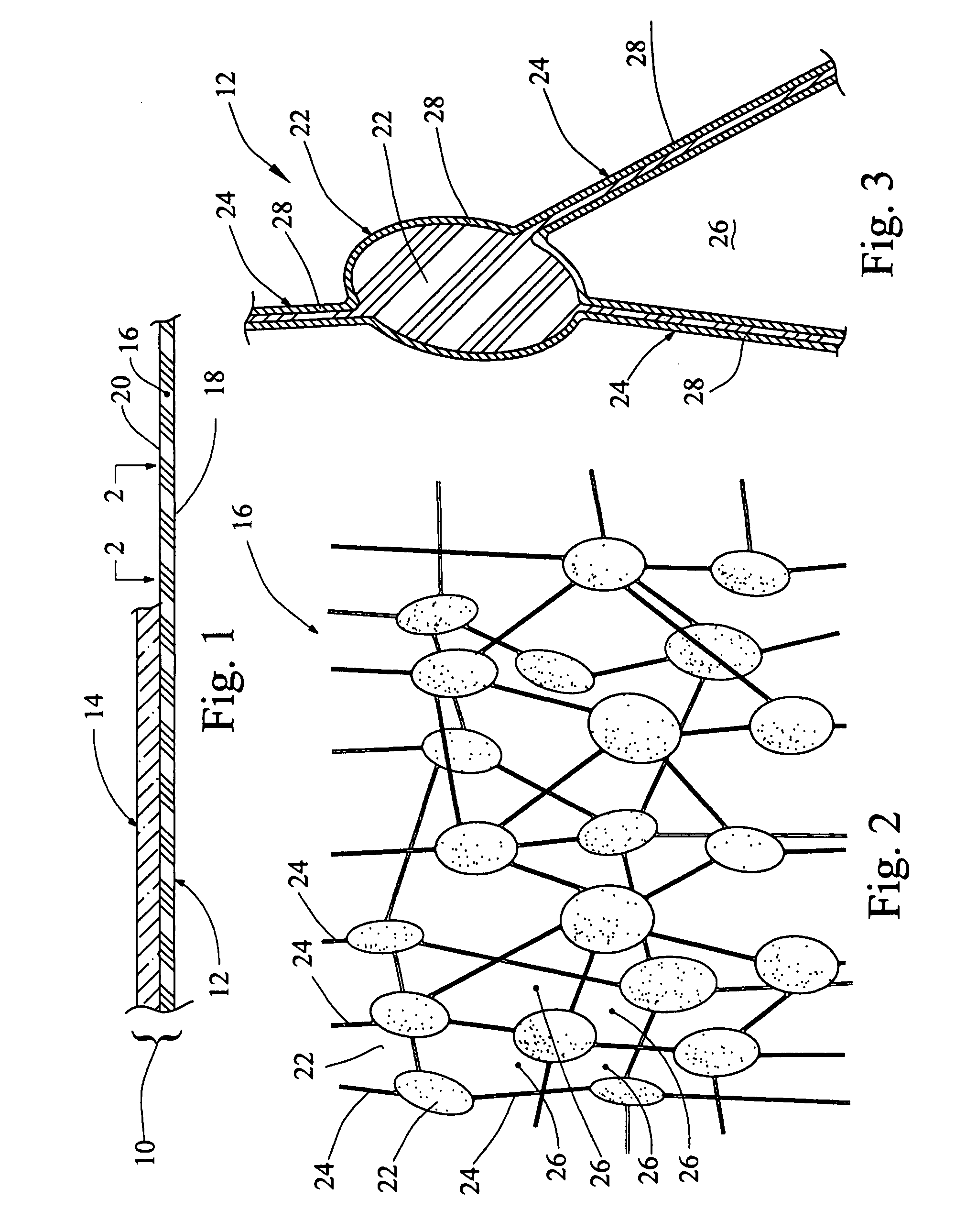 Porous membrane structure and method