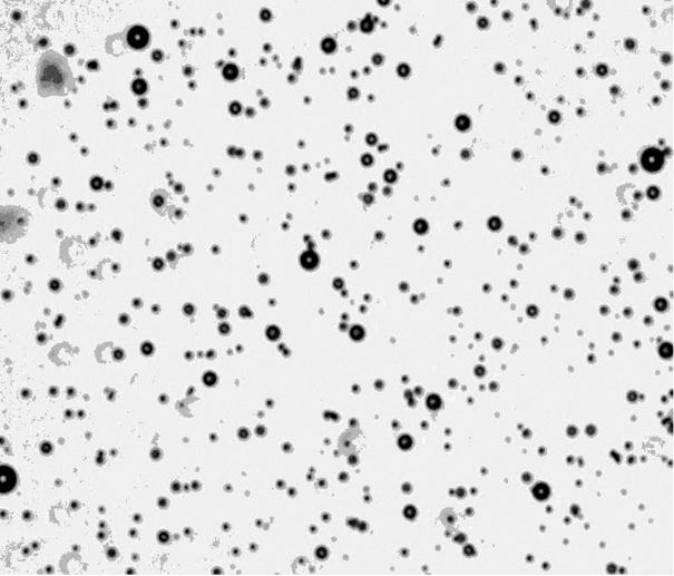 Method for preparing magnetic gene-loaded lipid ultrasonic microbubble contrast medium