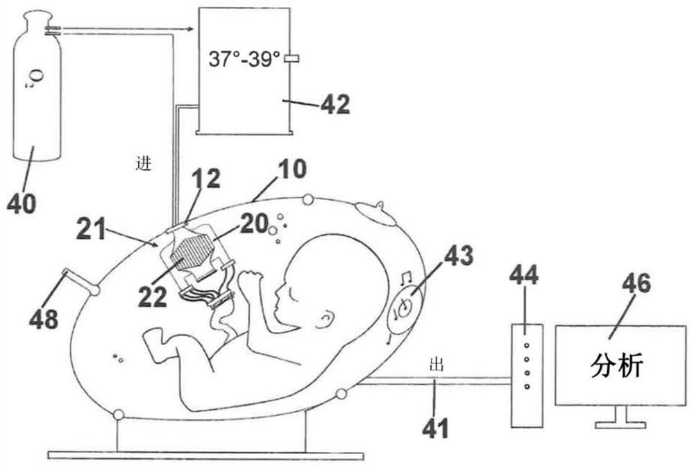 Device having an artificial gills system and use therof for supporting a newborn