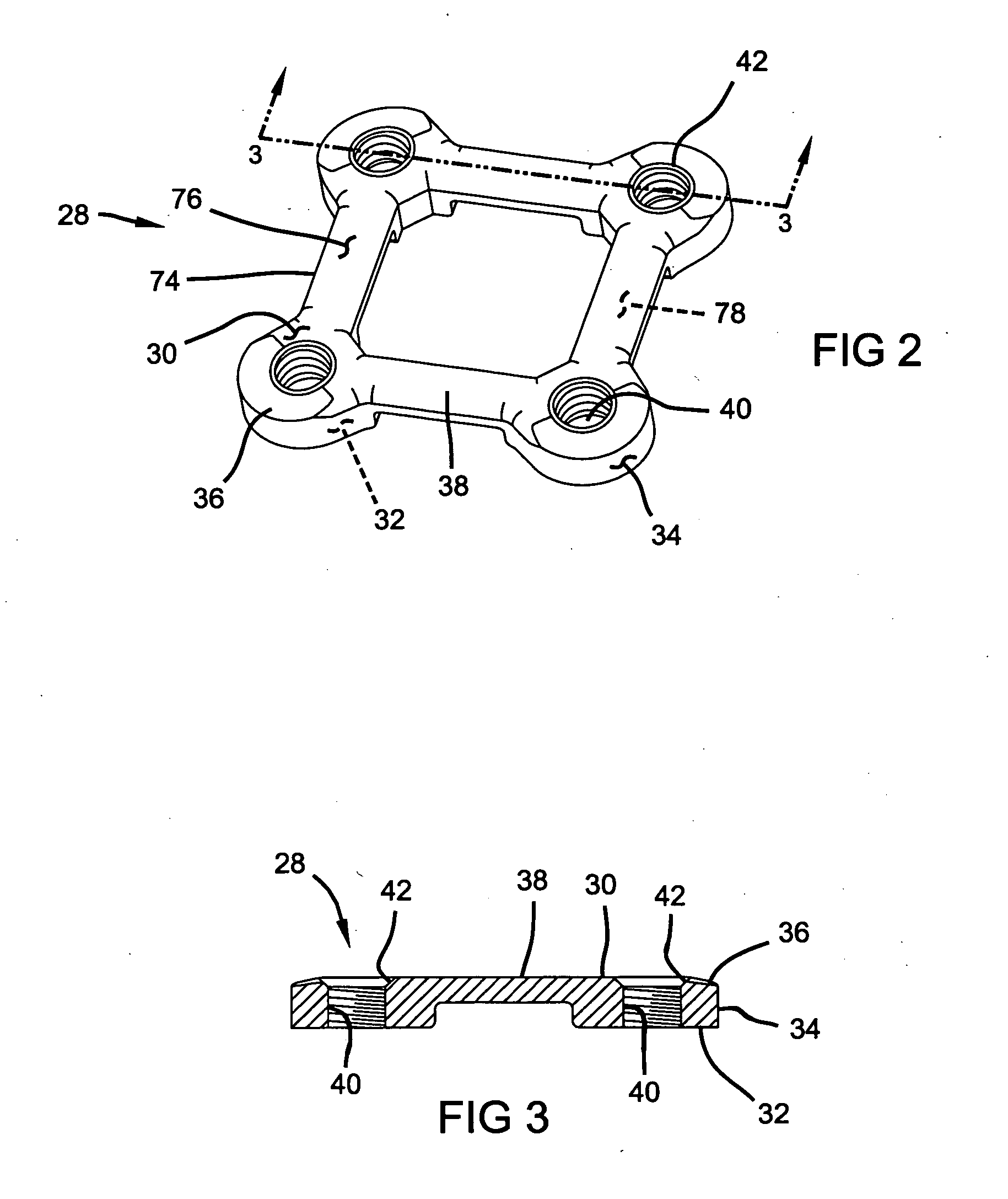 Method and apparatus for bone fracture fixation