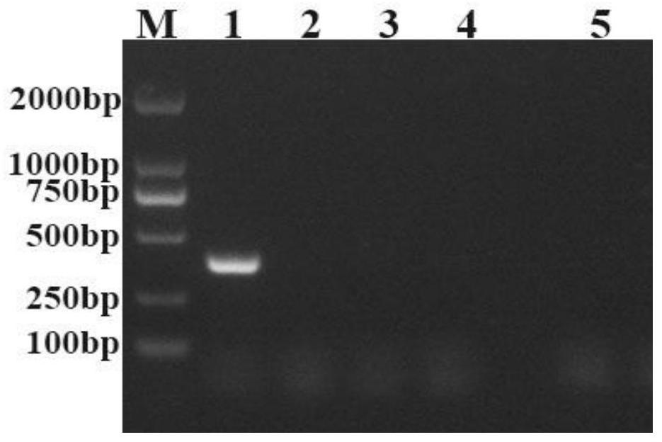 Avian paramyxovirus PCR universal detection primer, diagnostic reagent and kit