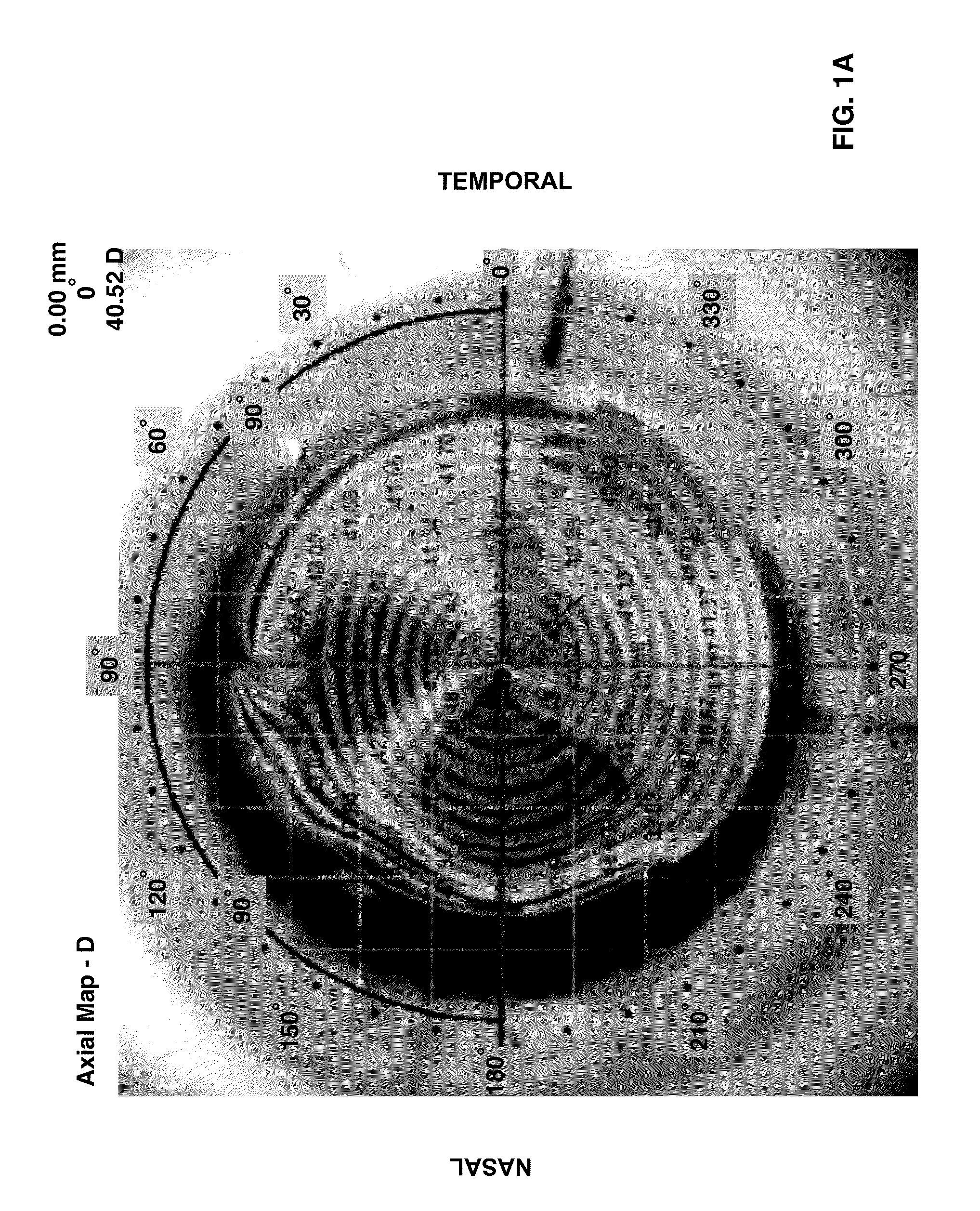 Tools and methods for the surgical placement of intraocular implants