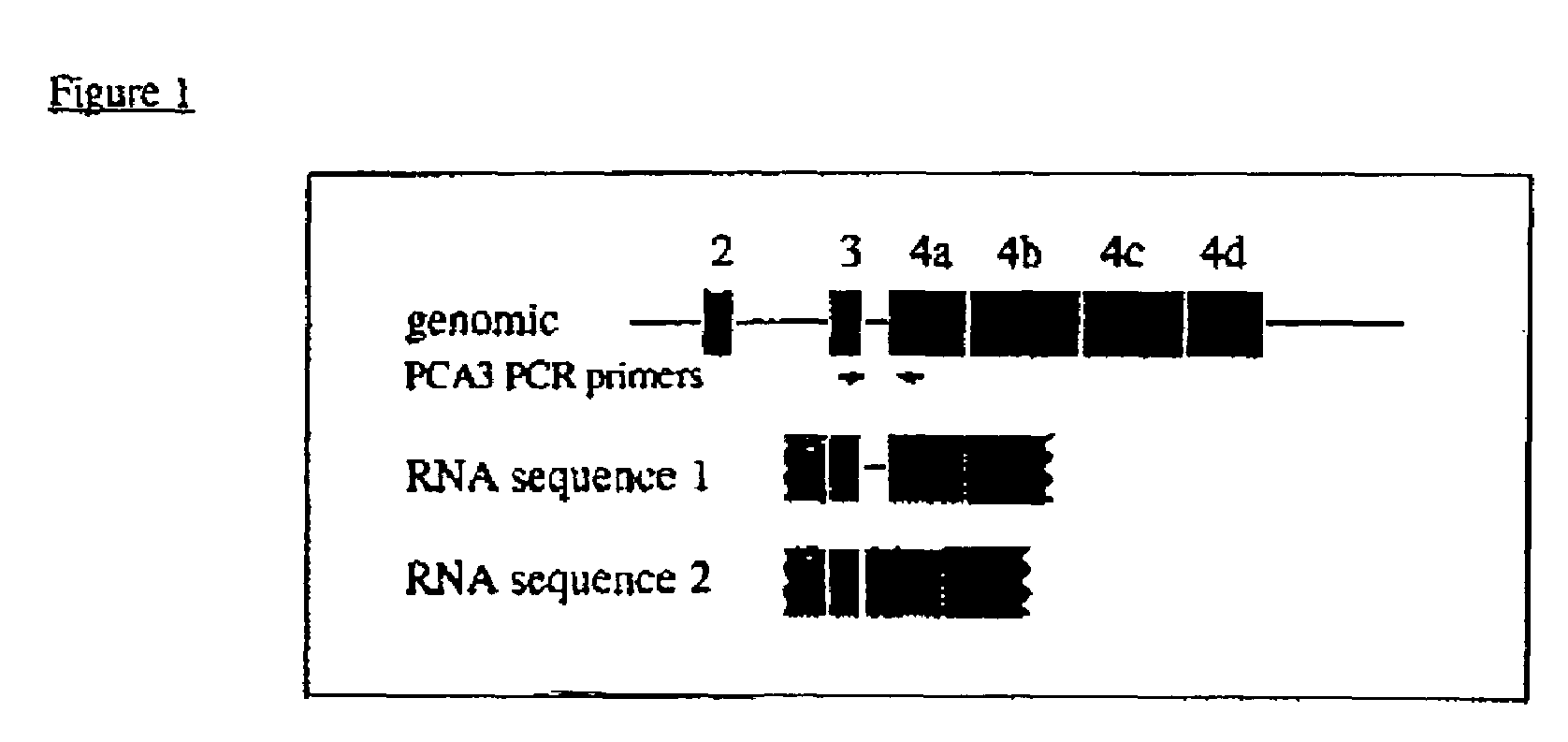 PCA3 messenger RNA species in benign and malignant prostate tissues