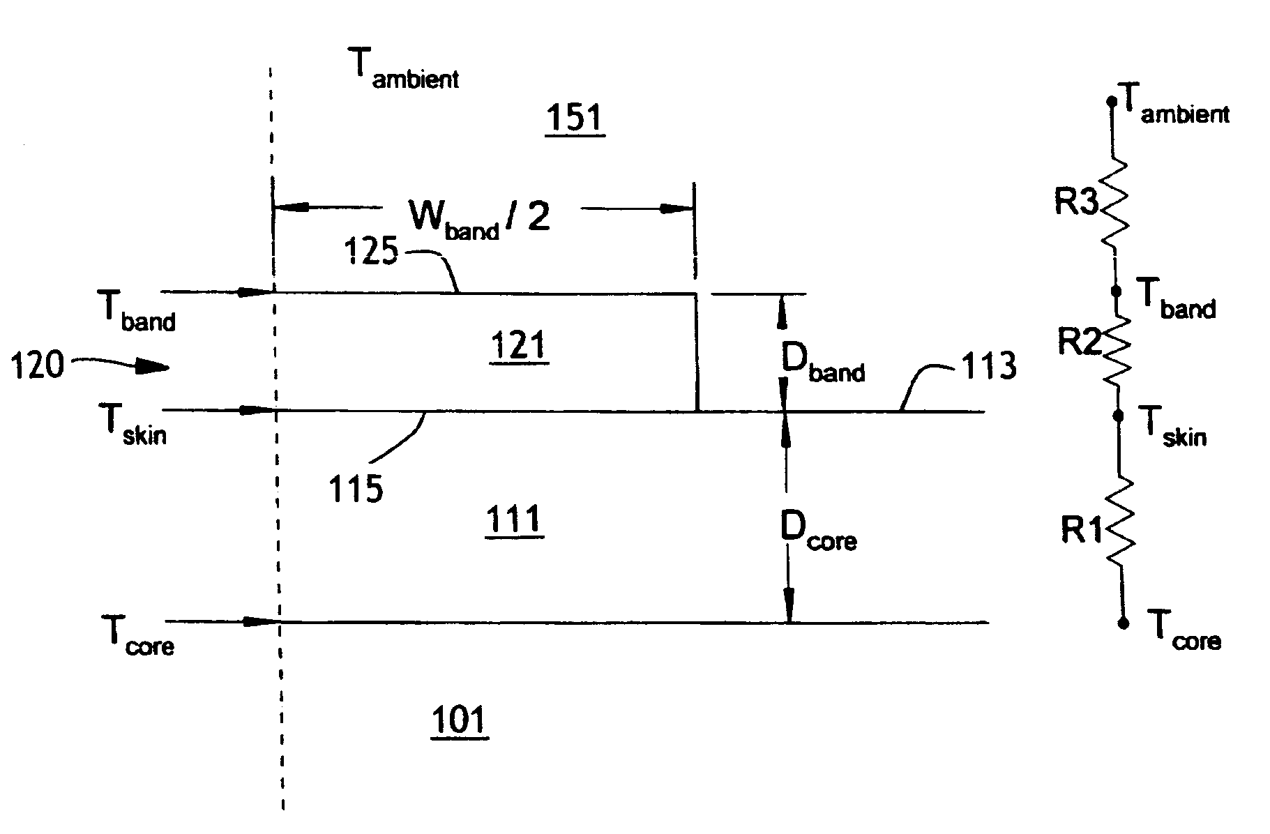 Method and Device For Monitoring Thermal Stress