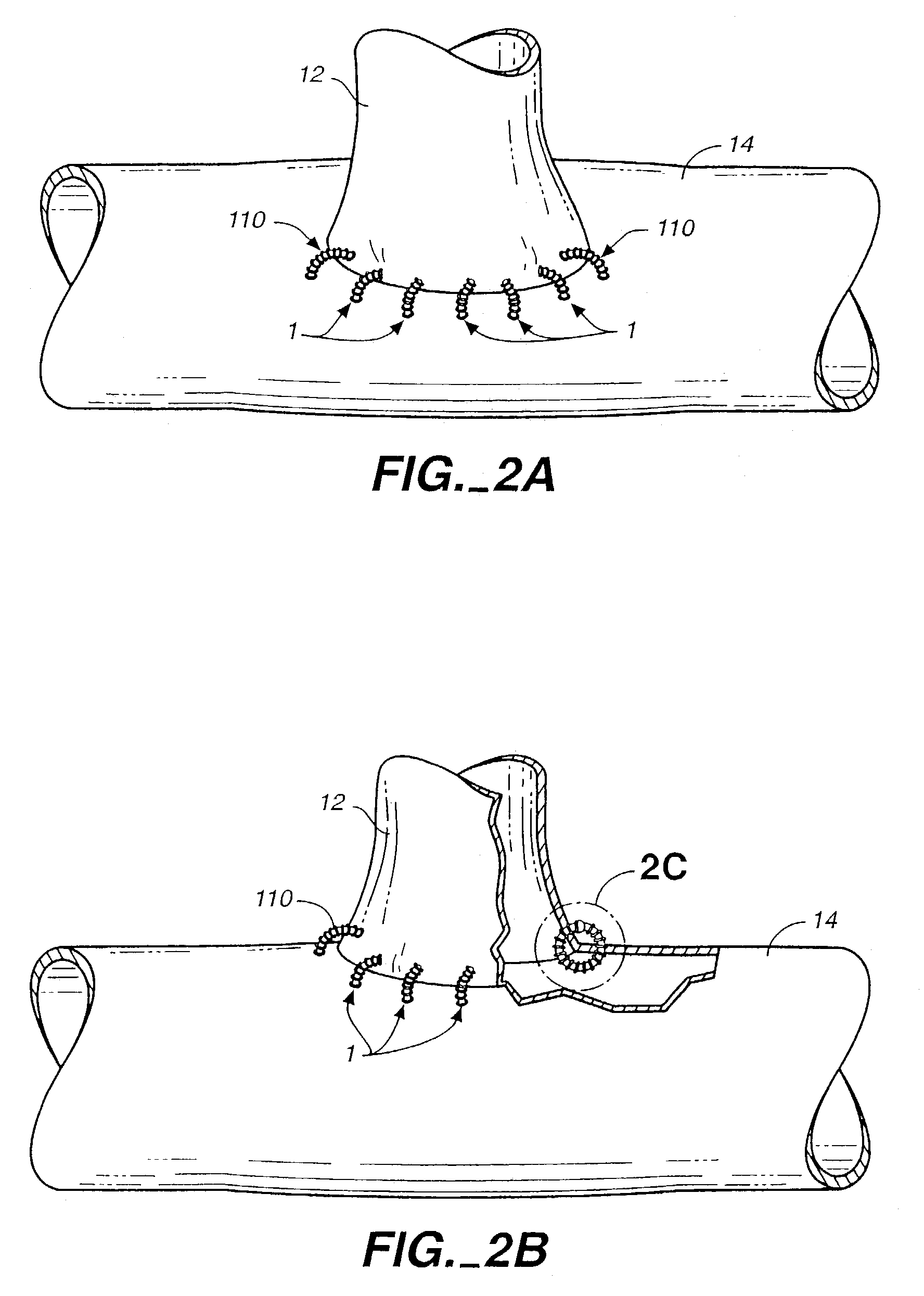Tissue connector apparatus and methods