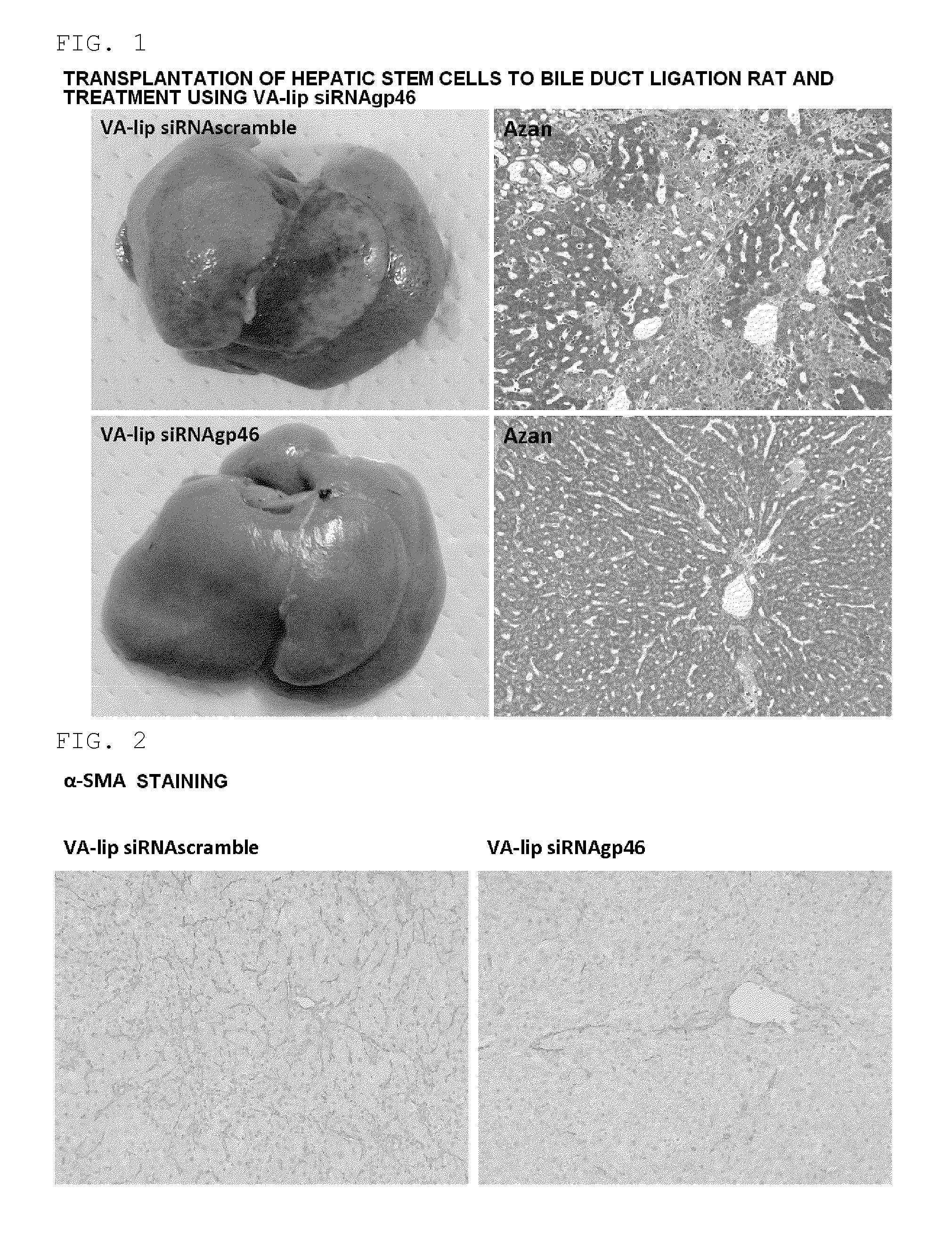 Composition for regenerating normal tissue from fibrotic tissue