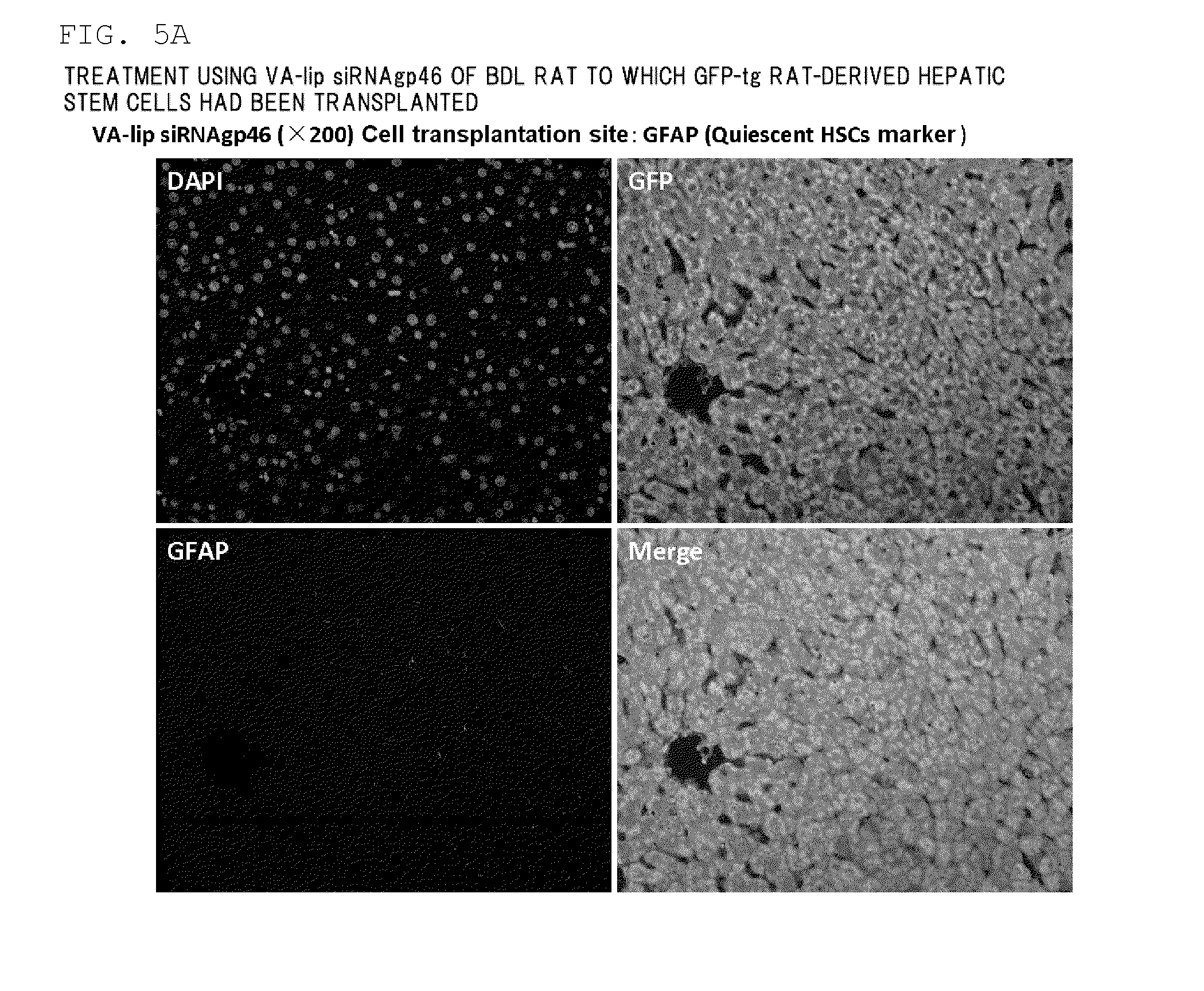 Composition for regenerating normal tissue from fibrotic tissue