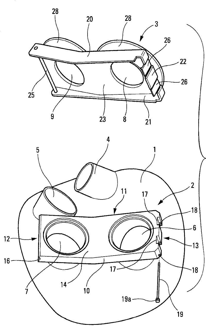 Device for rapid connection between a totally implantable heart prosthesis and natural auricles