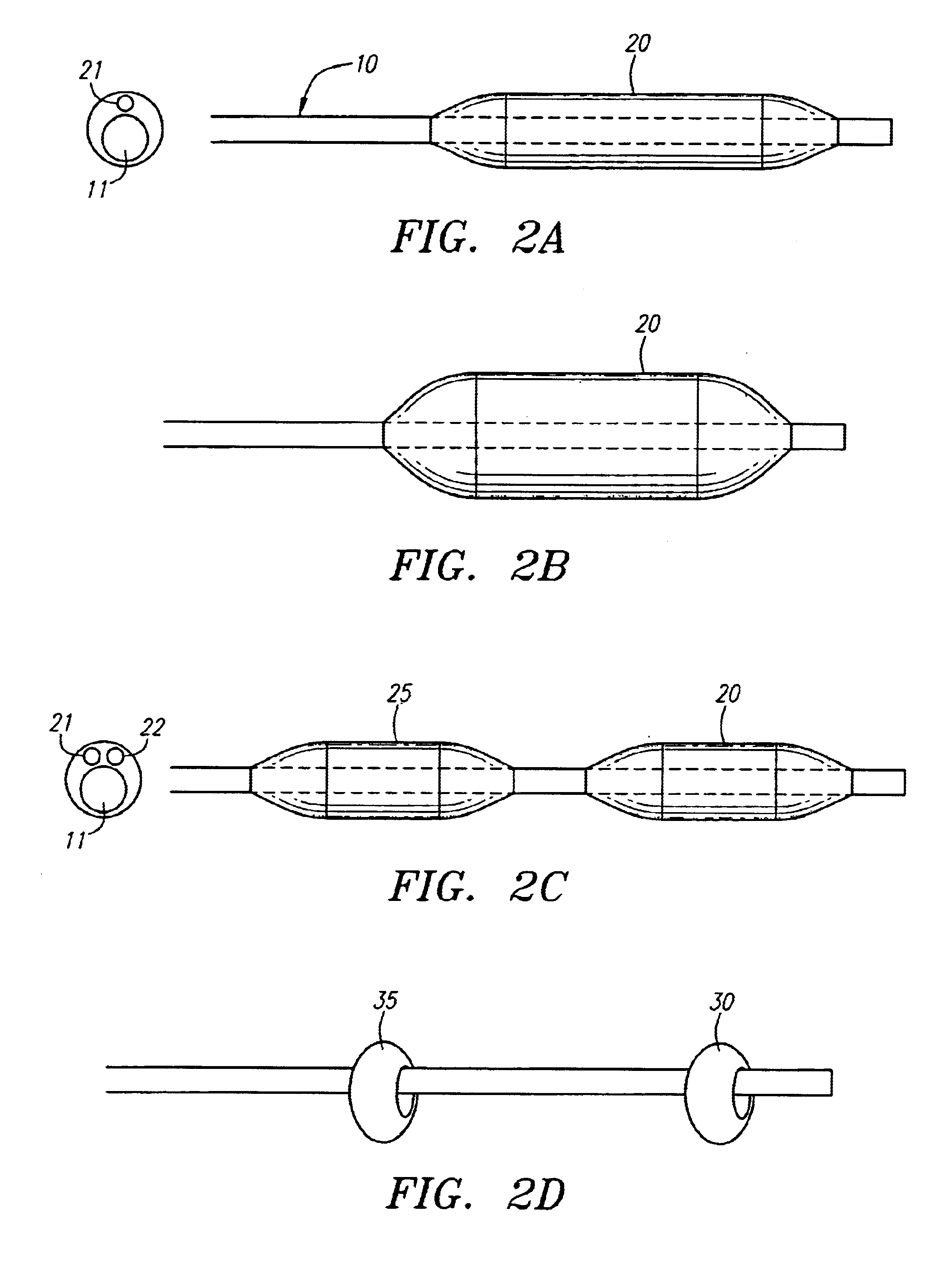 Devices and methods for cerebral perfusion augmentation