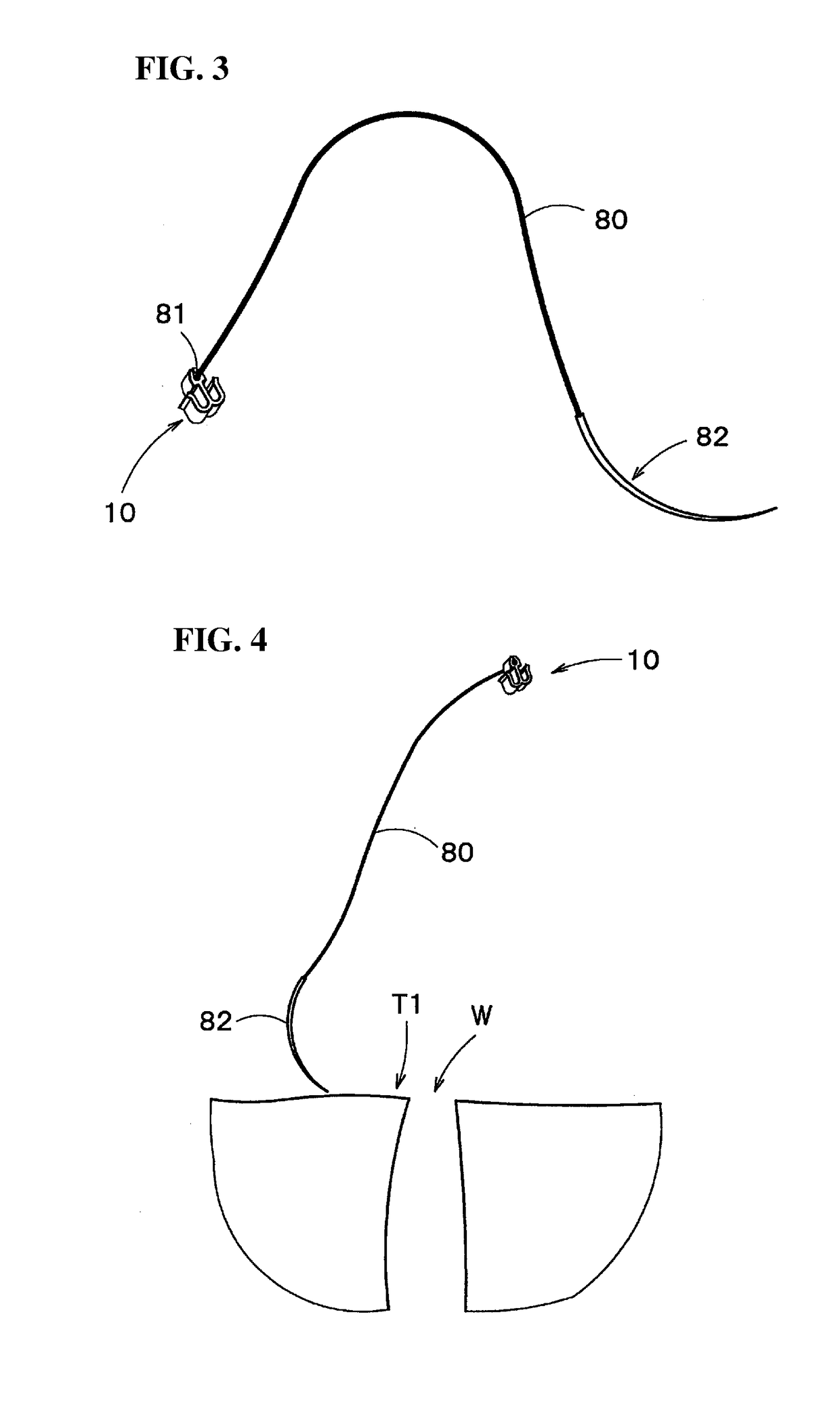 Anatomical-structure-ligating device