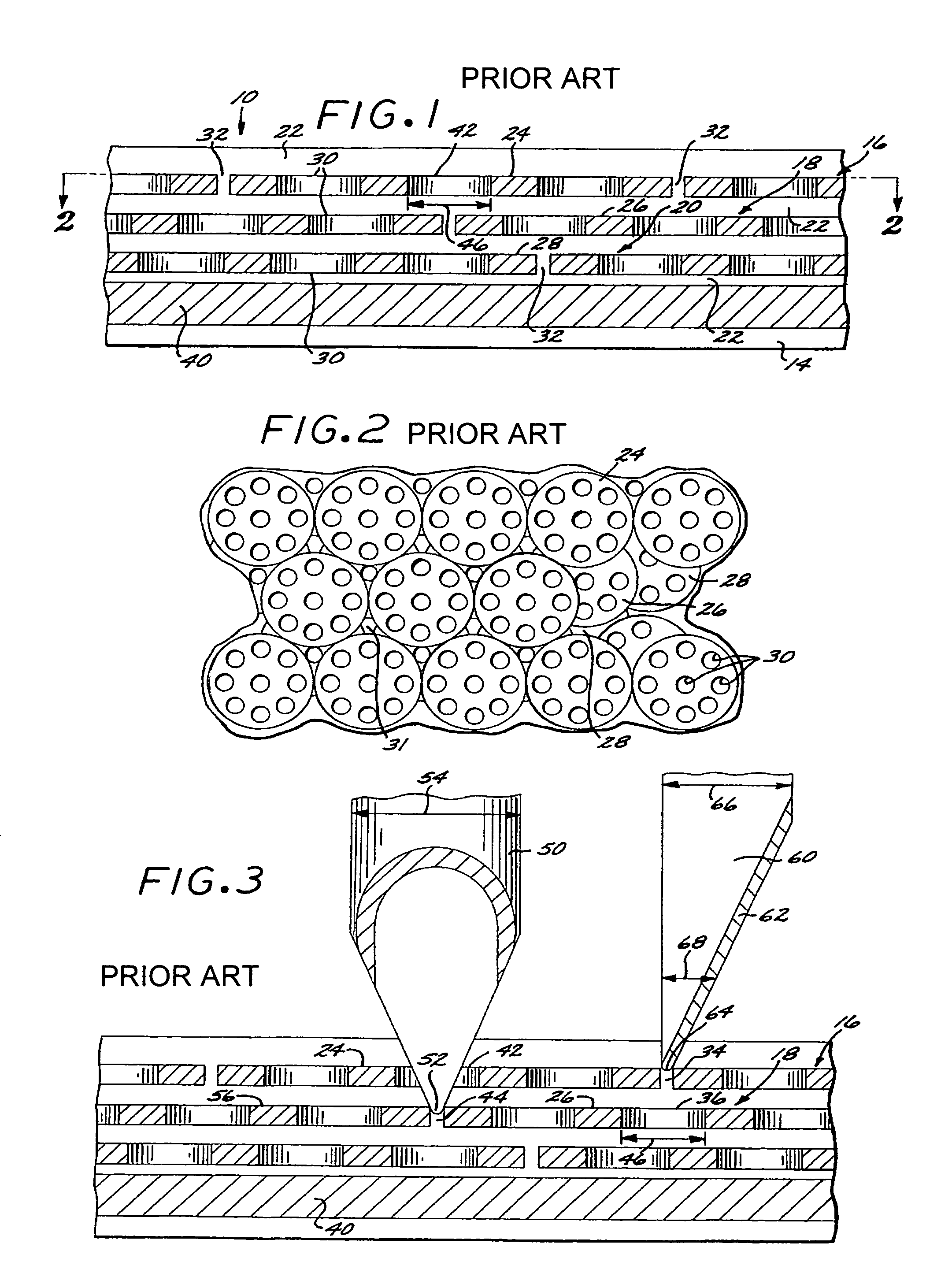 Puncture and cut resistant surgical glove with macrosphere capture devices