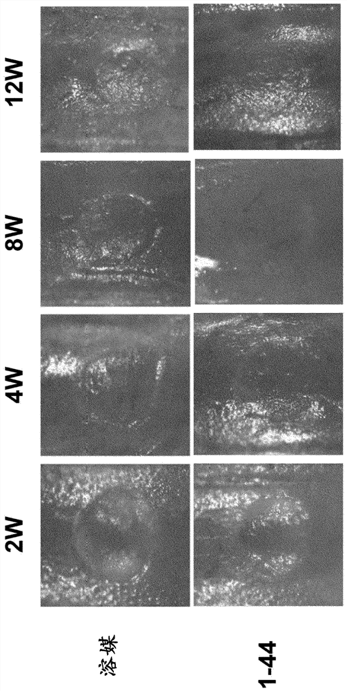 Therapeutic medication for cartilage disorder