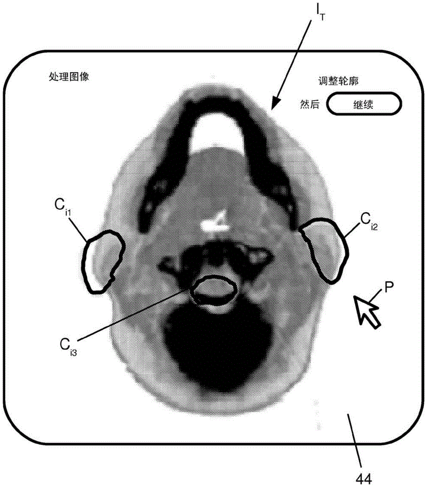 Integration of User Input and Correction of Deformable Vector Fields in a Deformable Image Registration Workflow