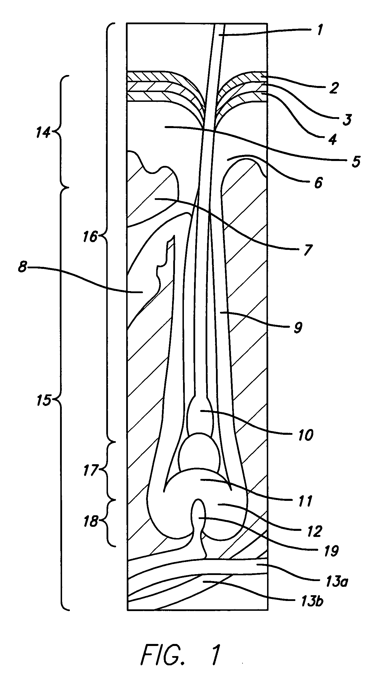 Hair-treatment or removal utilizing energy-guiding mechanisms