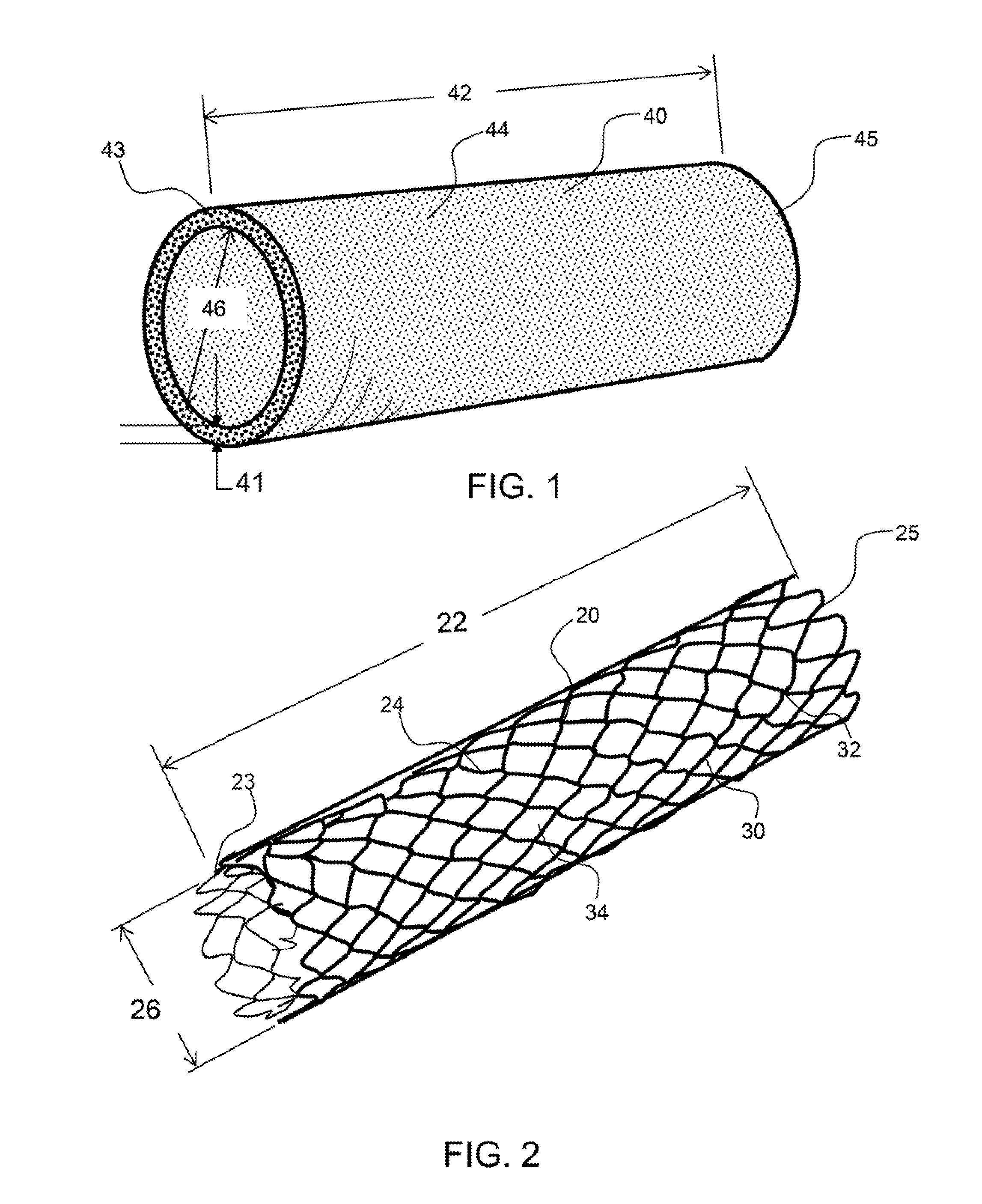 Radially compliant pressure indicating stent graft