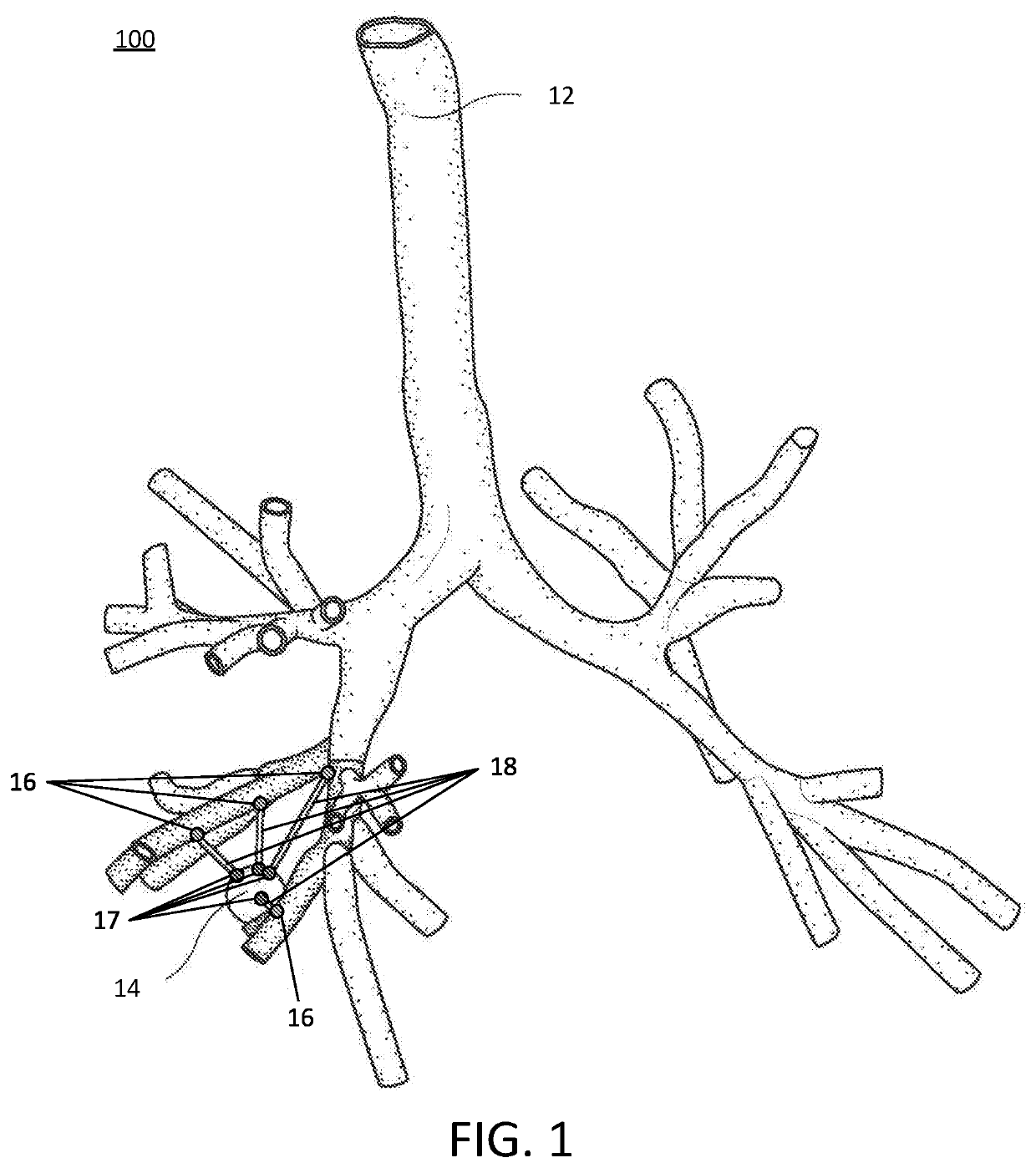 Pathway planning for use with a navigation planning and procedure system