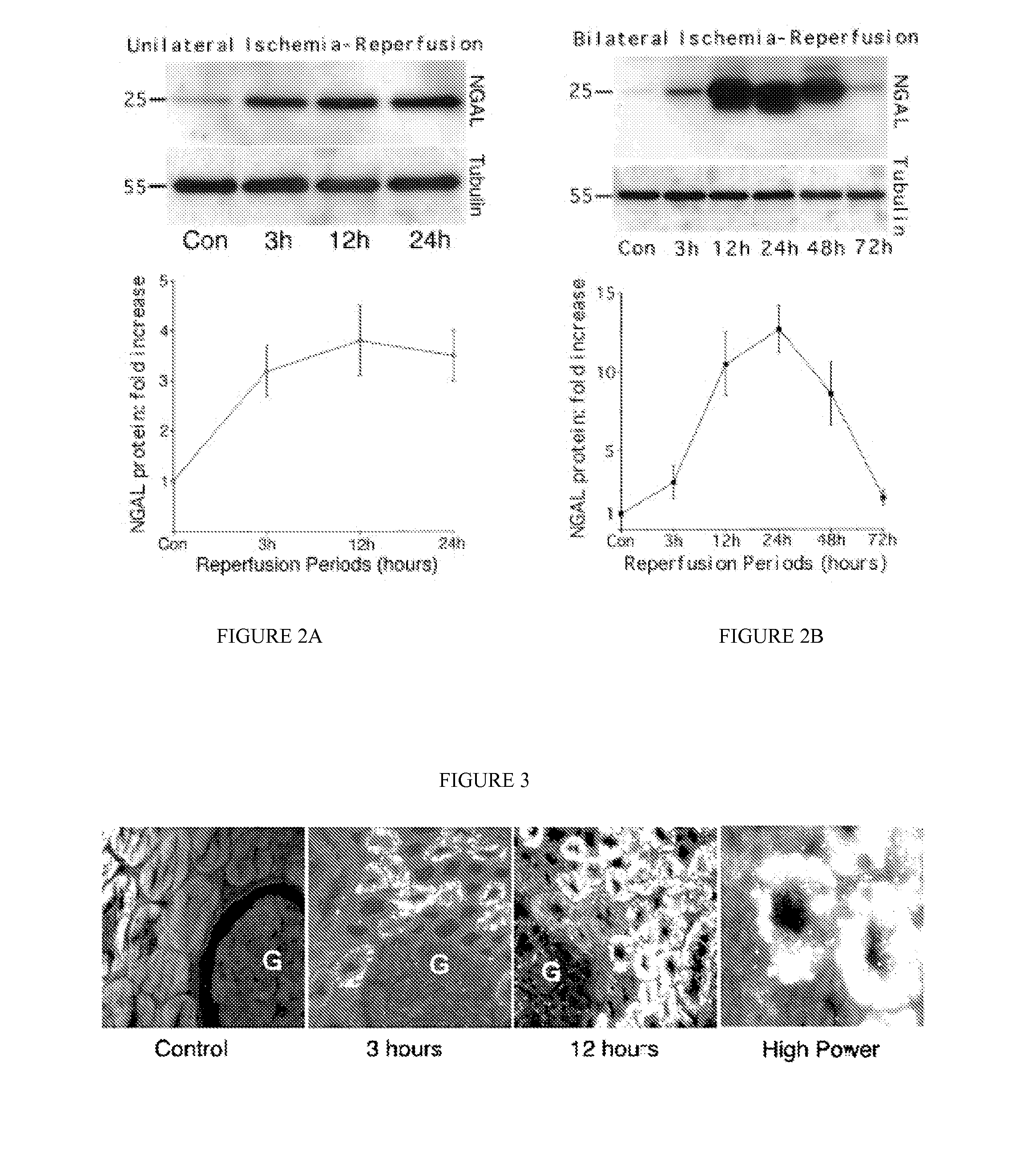 Method and kit for detecting the early onset of renal tubular cell injury