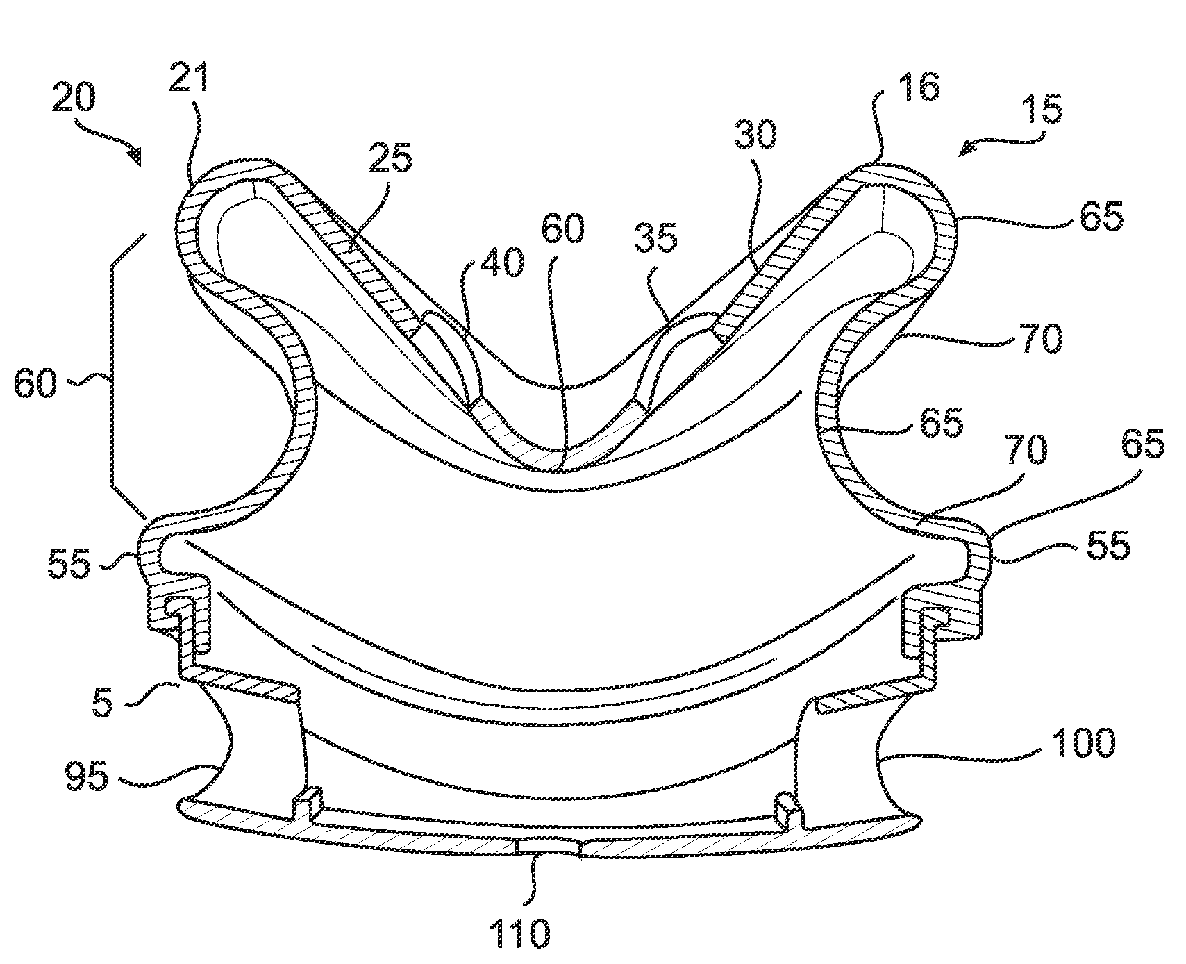 Butterfly nasal interface