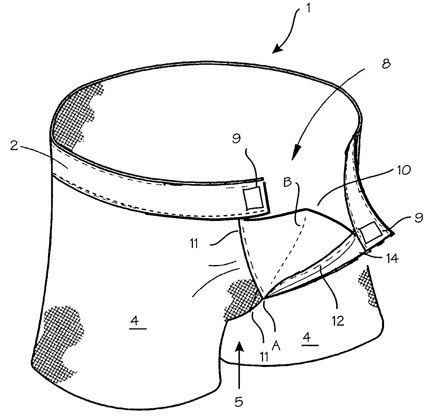 Garment with improved fly closure