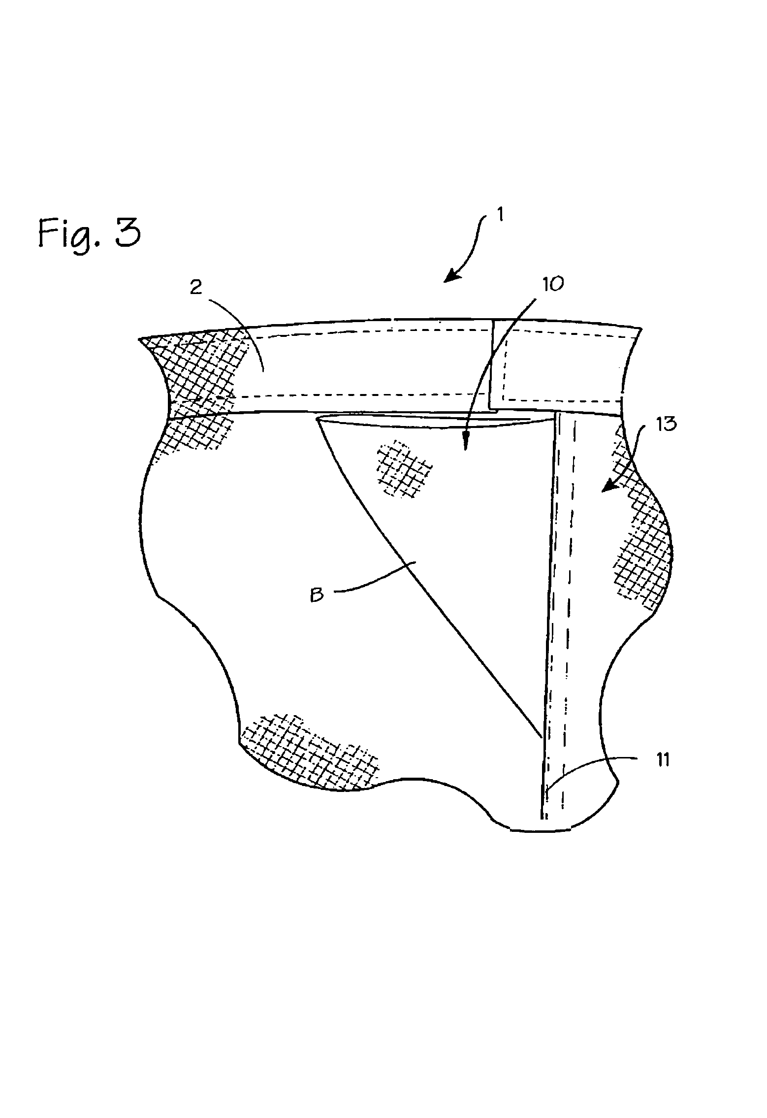 Garment with improved fly closure