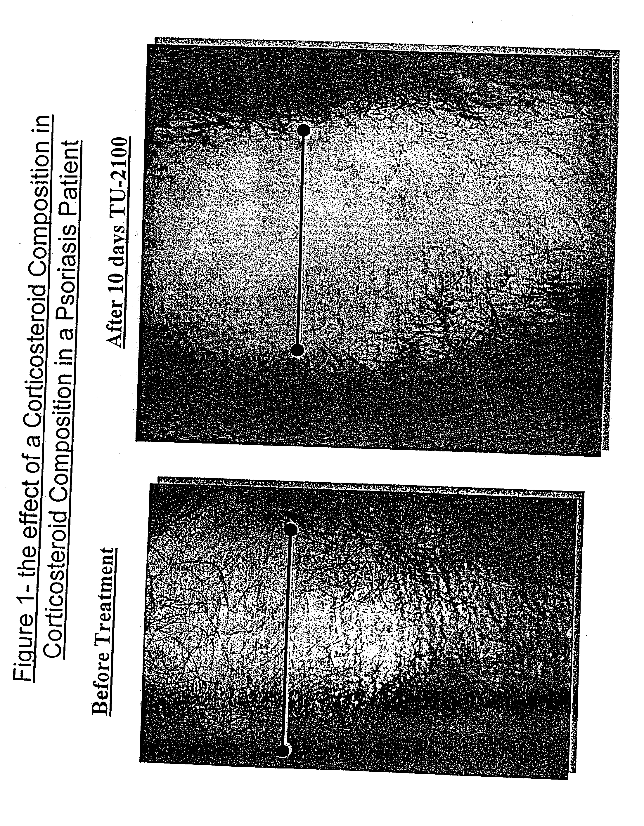 Dermatological application with solidified fat compositions