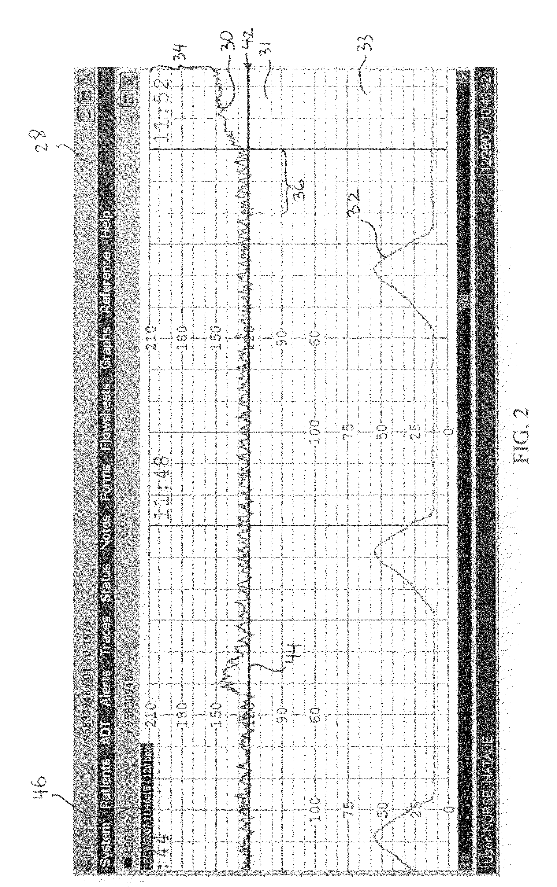 Electronic fetal monitoring assessment system and method
