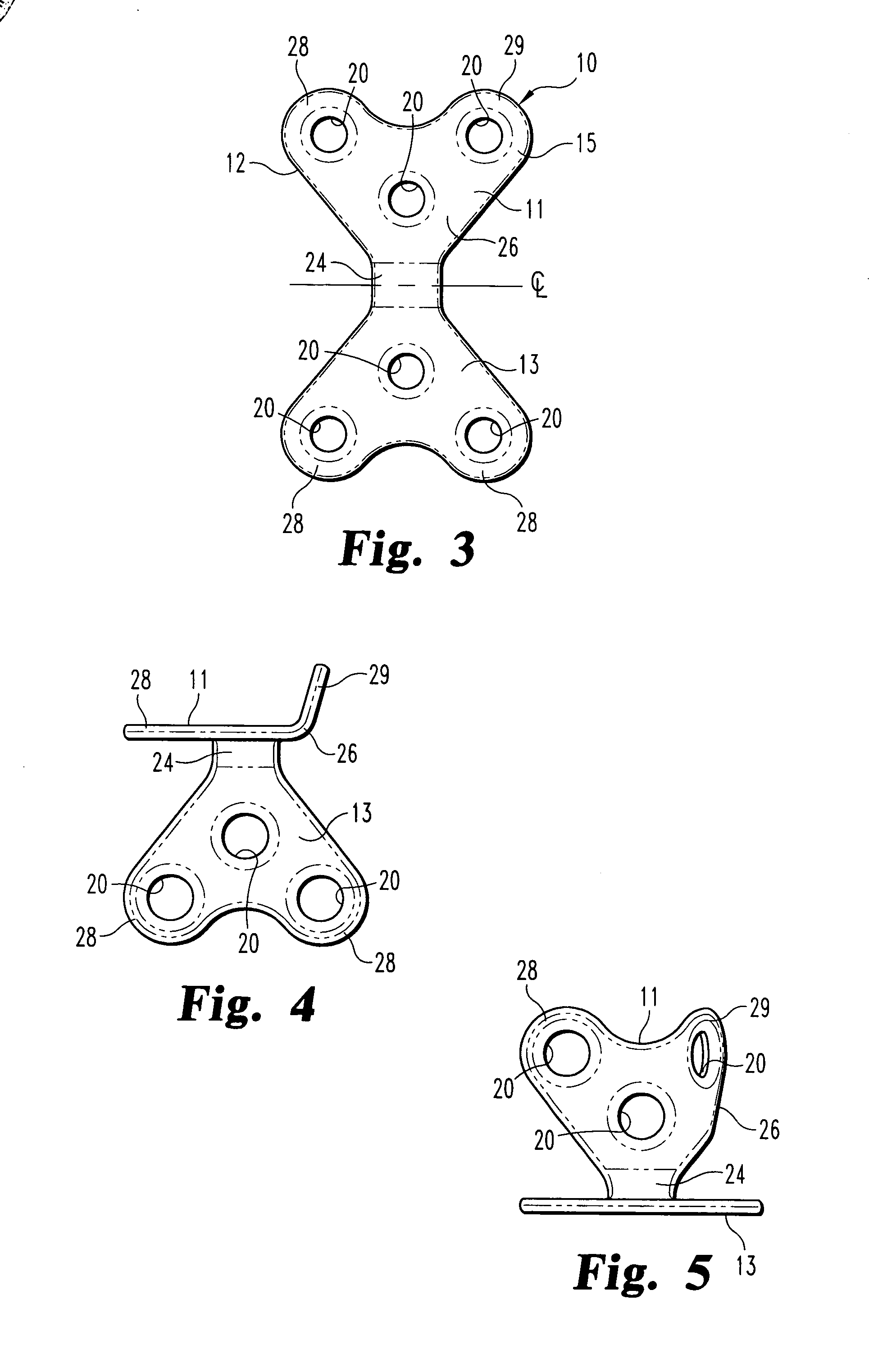 Fixation device for the talus