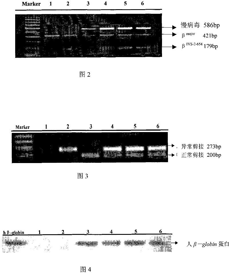 Method for preparing beta IVS-II-654 transgene mouse model carrying human beta globin gene