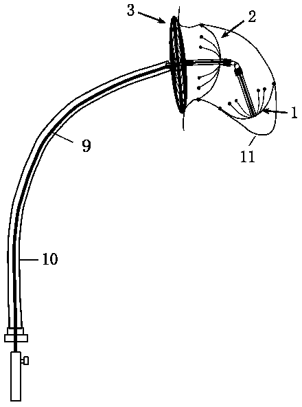 Double umbrella type left auricle sealing device