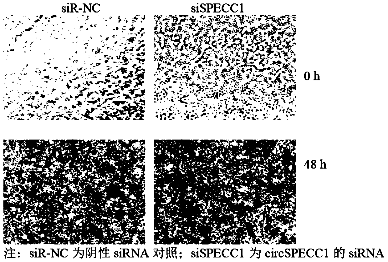 CircSPECC1 for brain glioma treatment, and usage thereof