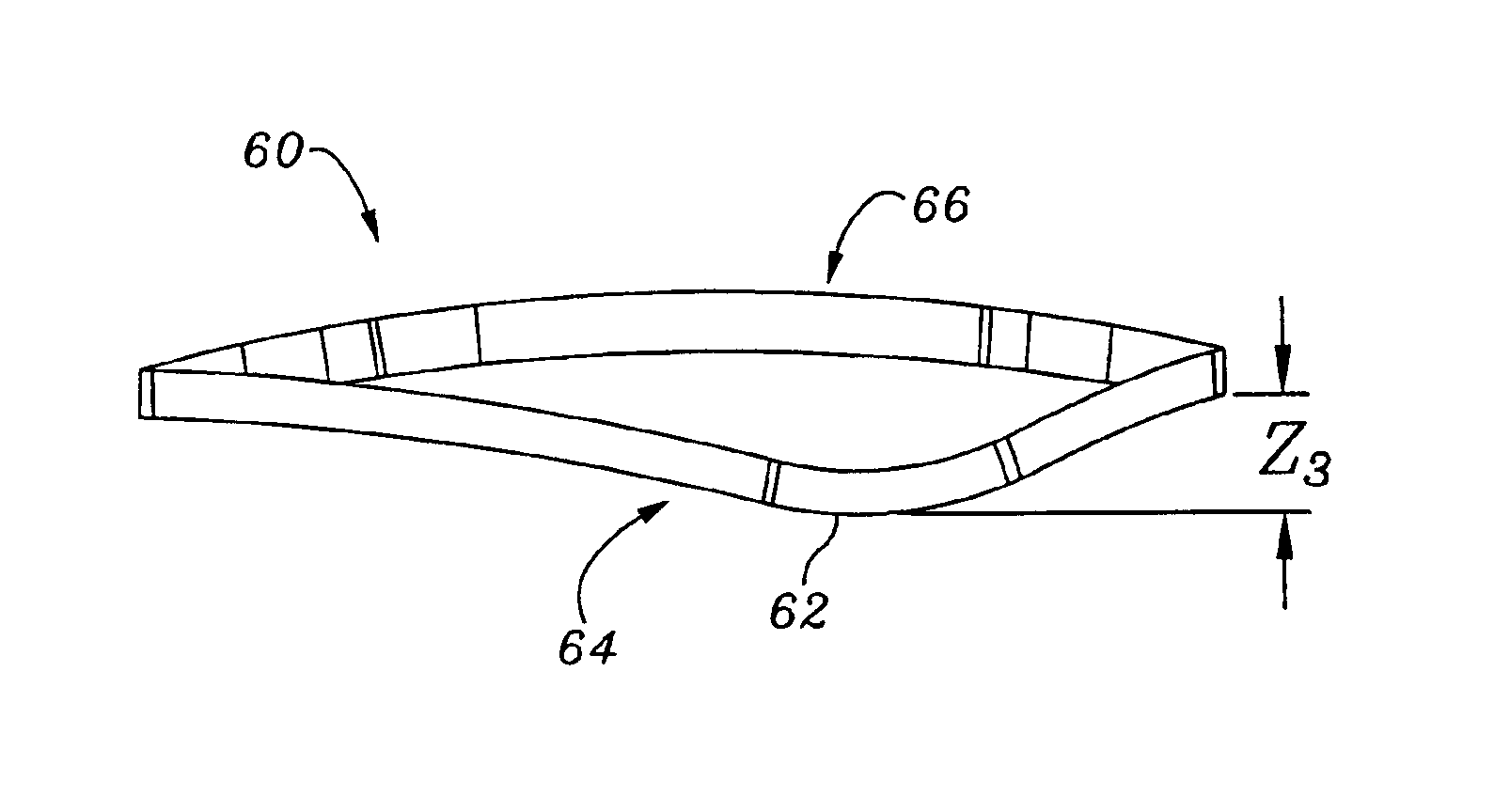Mitral valve annuloplasty ring having a posterior bow