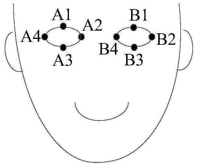 Image processing method, model training method, device, device and medium