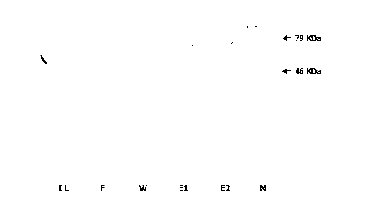 Preparation method of human protein lysine methyltransferase SET9 fusion protein