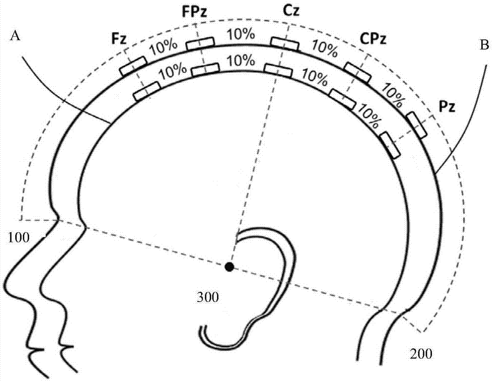 A device that can be mounted on the head and has electrodes for electroencephalography