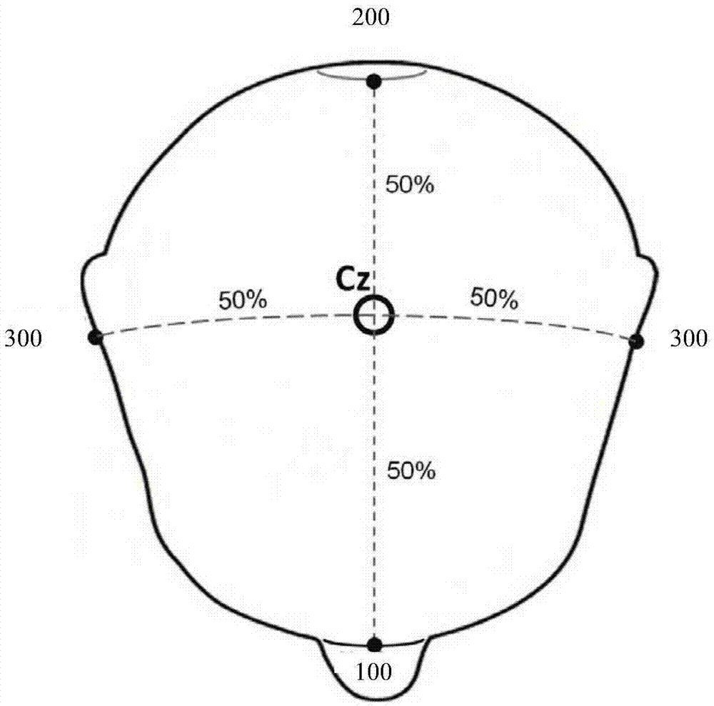 A device that can be mounted on the head and has electrodes for electroencephalography