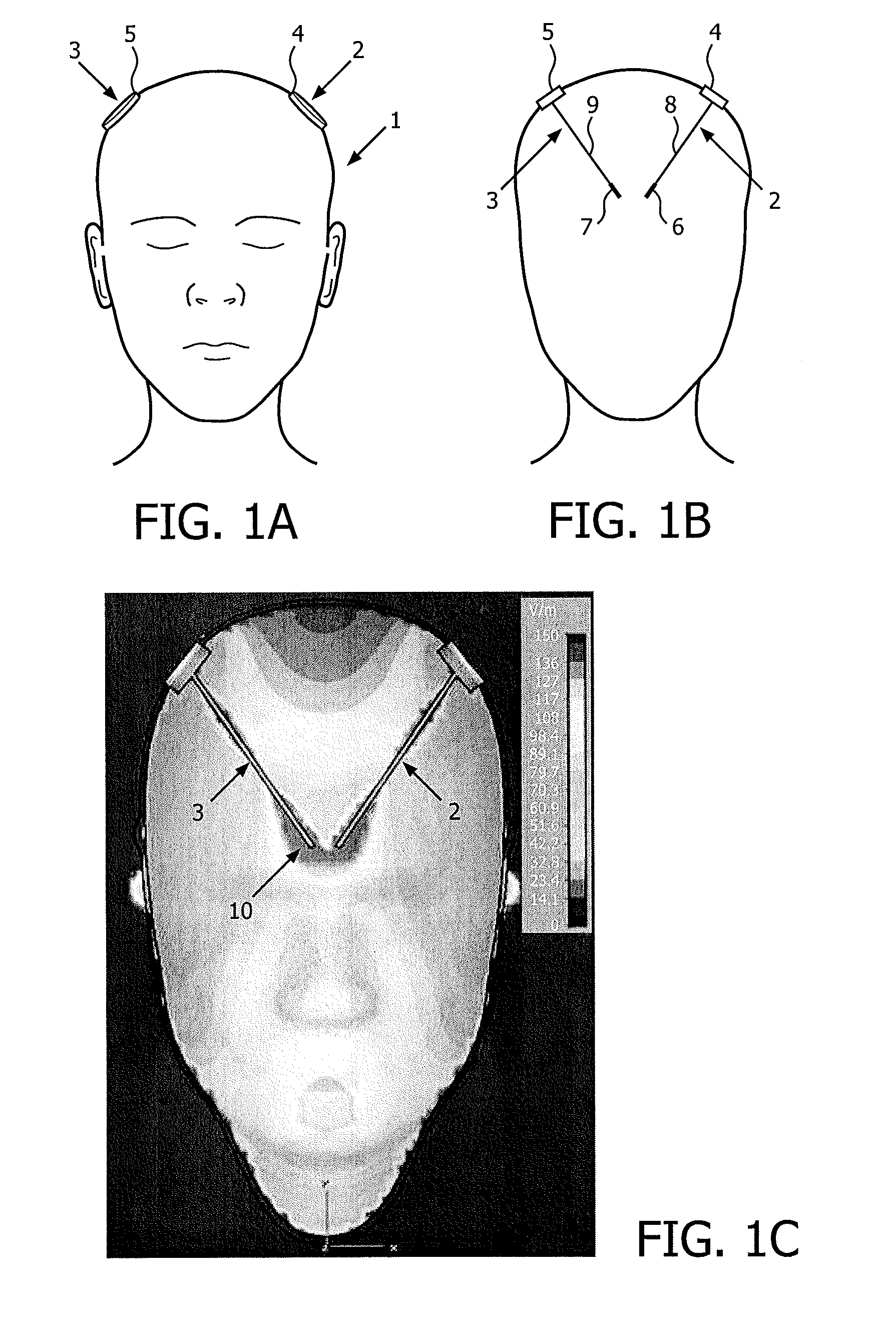 Medical Device for Electrical Stimulation