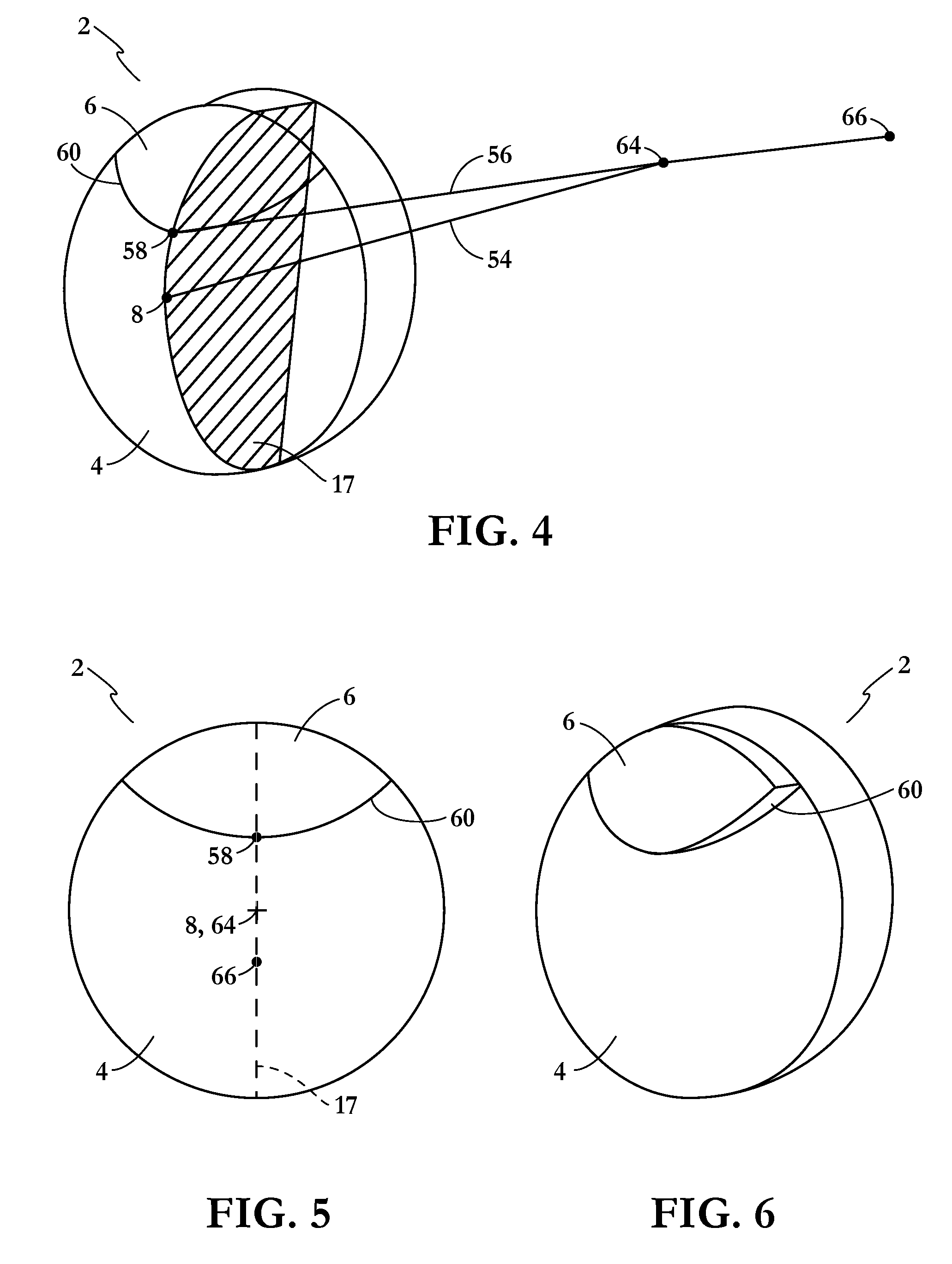 Non-progressive multifocal lens with large near/intermediate area