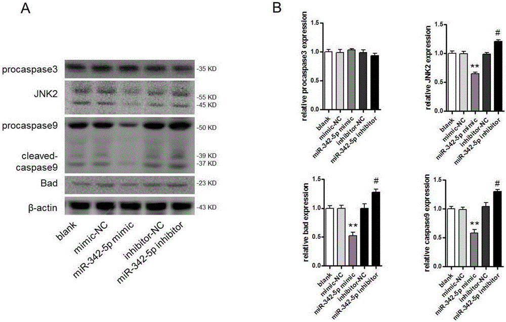 Application of miR-342-5p in preparation of drug for preventing and treating heart disease